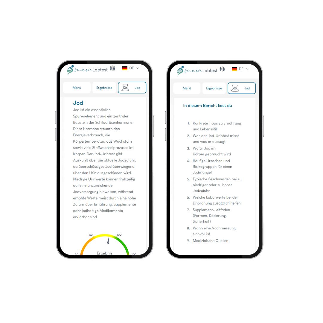 Zwei Smartphones zeigen Testergebnisse. Texte über Jod. Kreisdiagramm mit Ergebnis.
