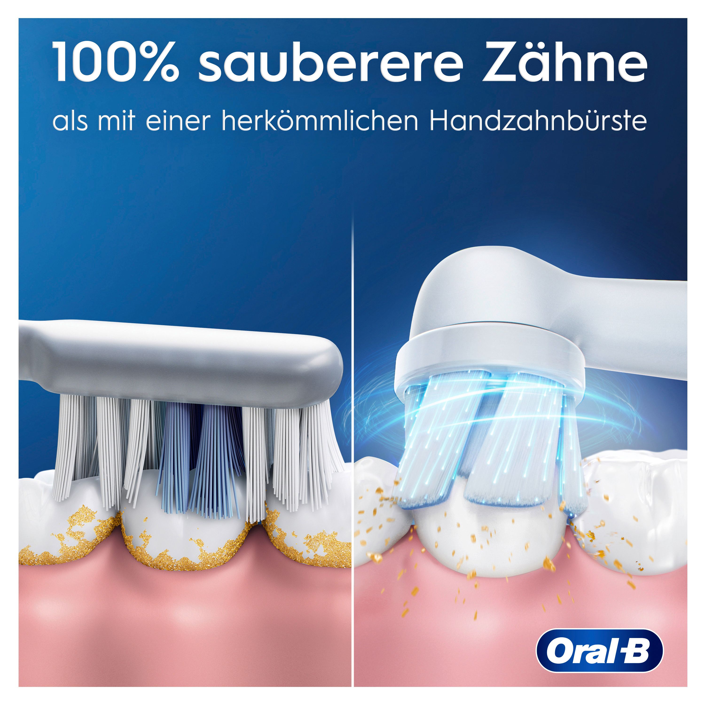 Vergleich von Zähnen vor und nach dem Putzen mit einer elektrischen Zahnbürste. Deutliche Verbesserung der Sauberkeit.