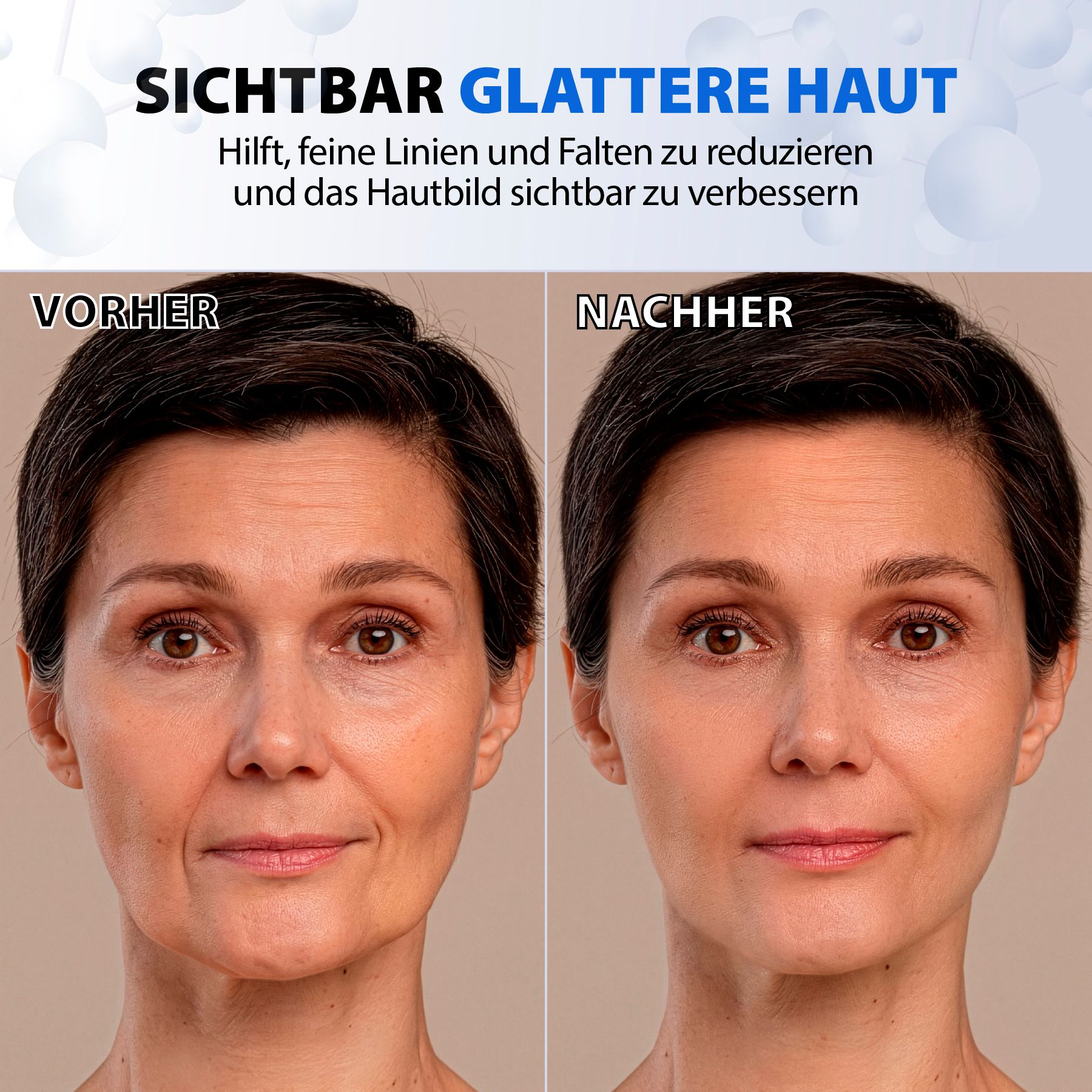 Vorher-Nachher-Vergleich einer Frau mit Faltenreduktion im Gesicht.