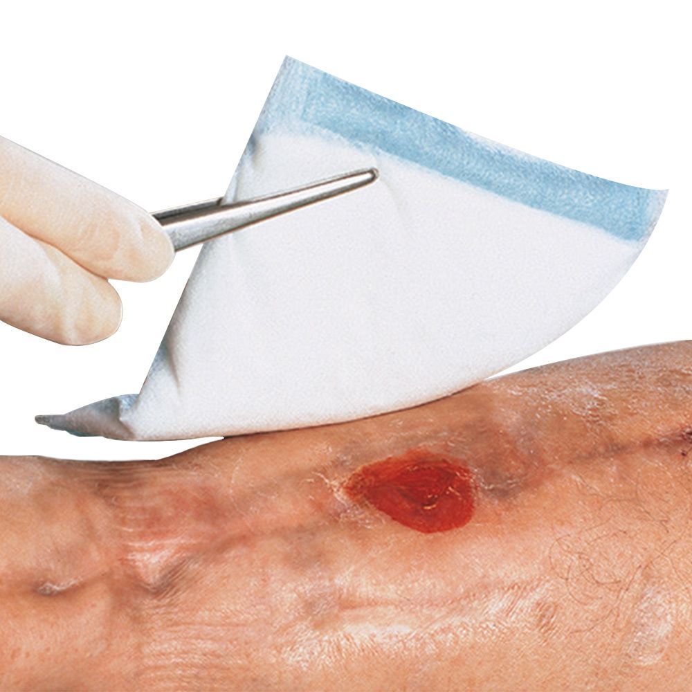 Wundkompresse wird mit einer Pinzette auf eine Hautwunde gelegt. Die Kompresse ist weiß mit blauem Rand.
