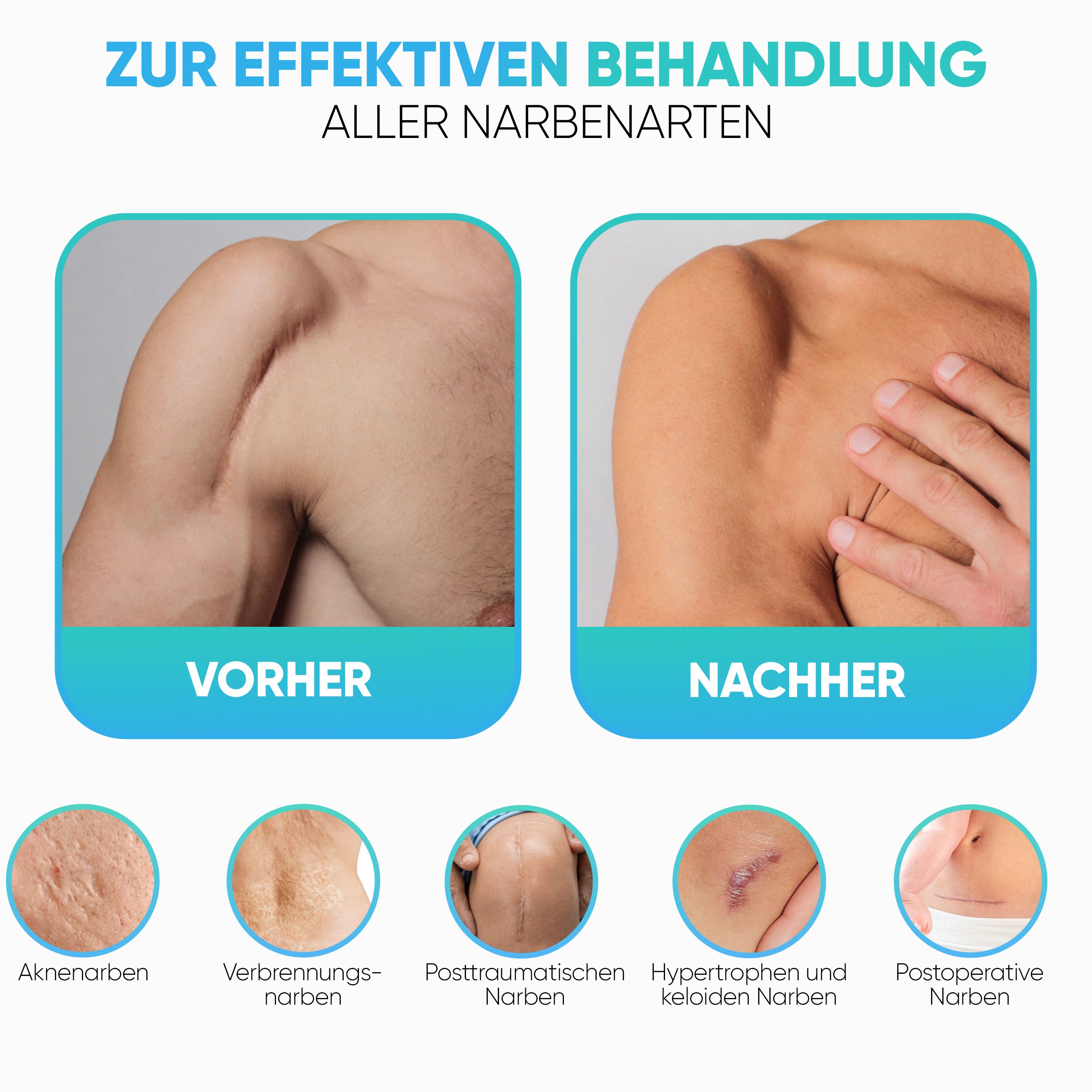 Health Press Narben Gel