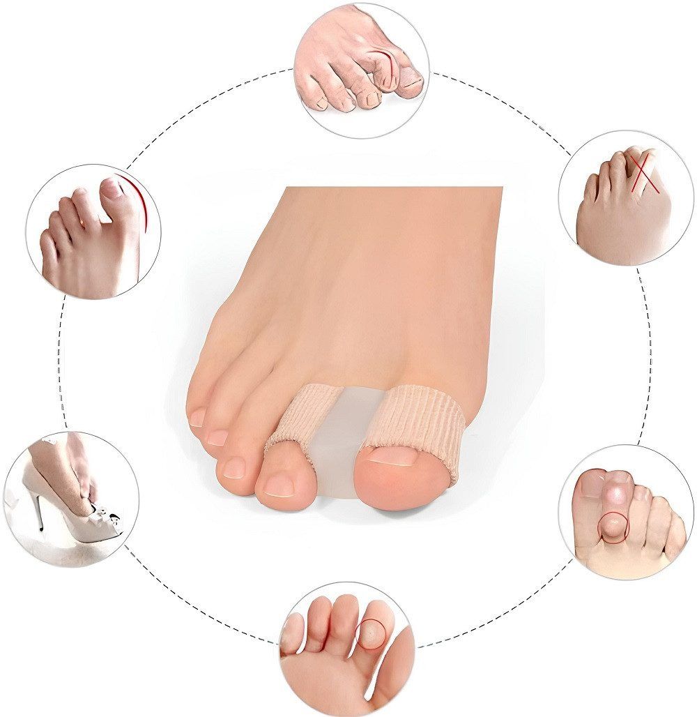 Ein Fuß mit Zehenspreizer, umgeben von Illustrationen verschiedener Fußstellungen.