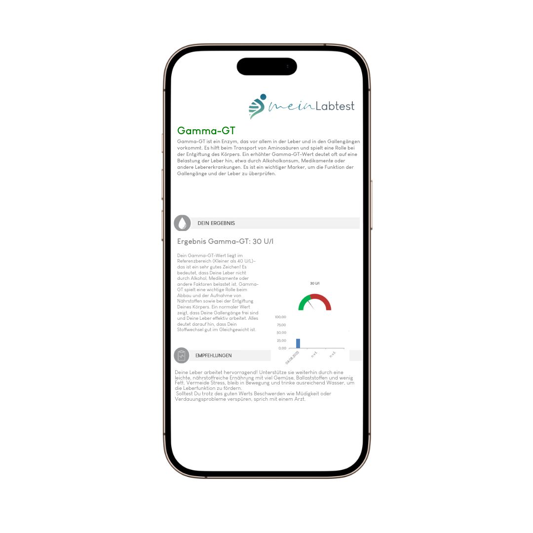 Smartphone mit Meinlabtest-App. Anzeige von Gamma-GT-Testergebnissen mit Diagramm und Informationen.