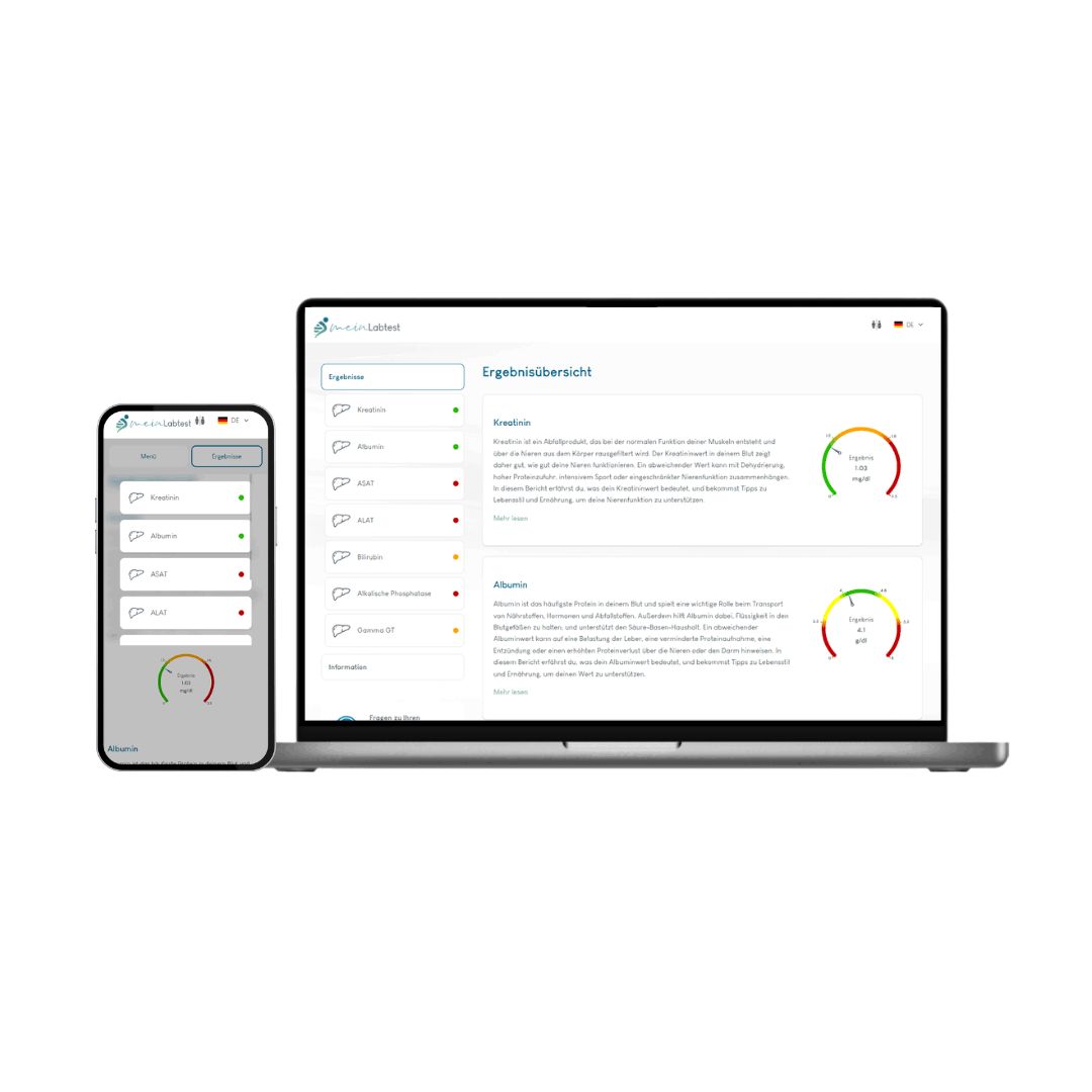 Smartphone und Laptop mit Meinlabtest-Ergebnissen. Ergebnisse mit farbigen Balken. Logo Meinlabtest.