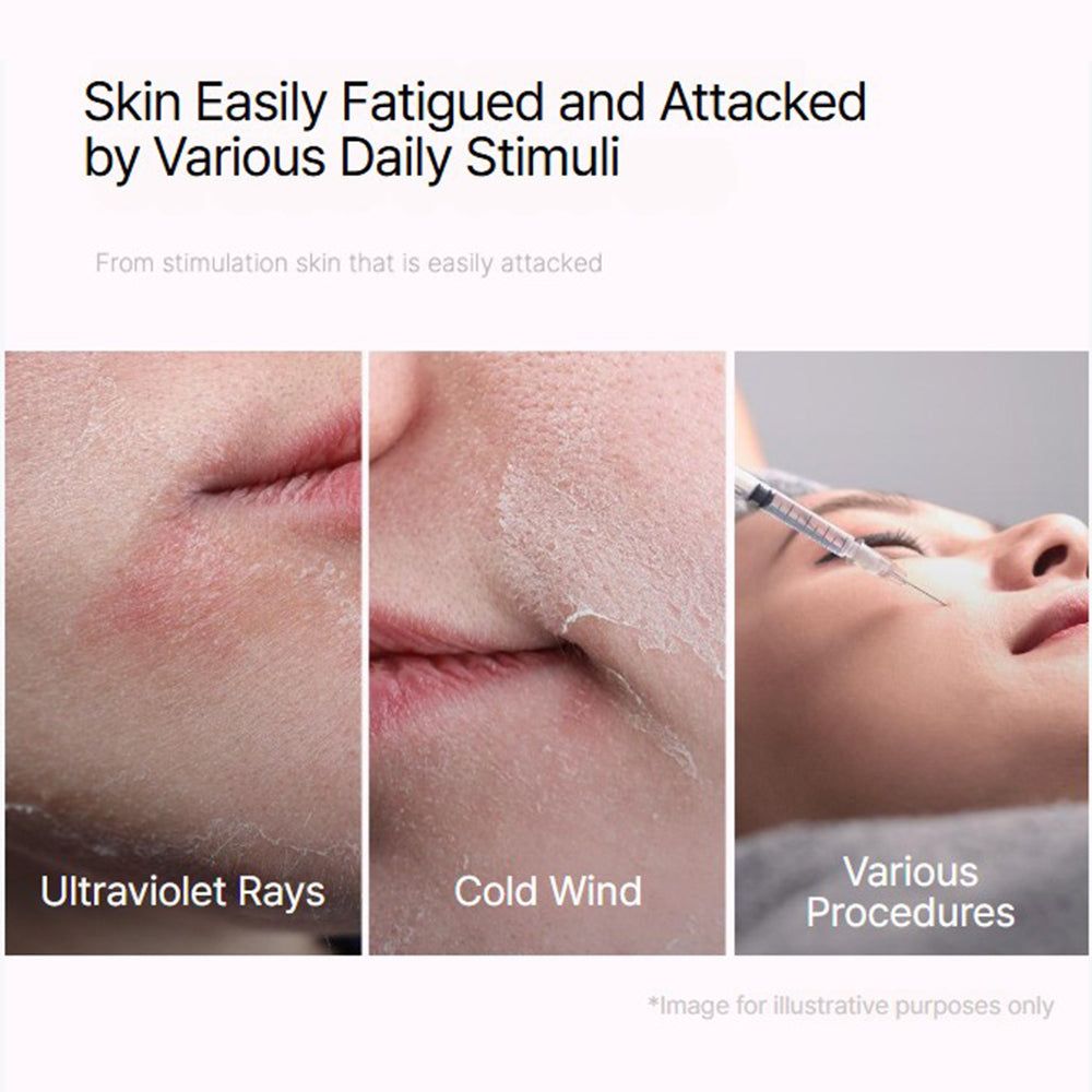 Drei Bilder zeigen Hautschäden durch UV-Strahlen, kalten Wind und Verfahren. Text.