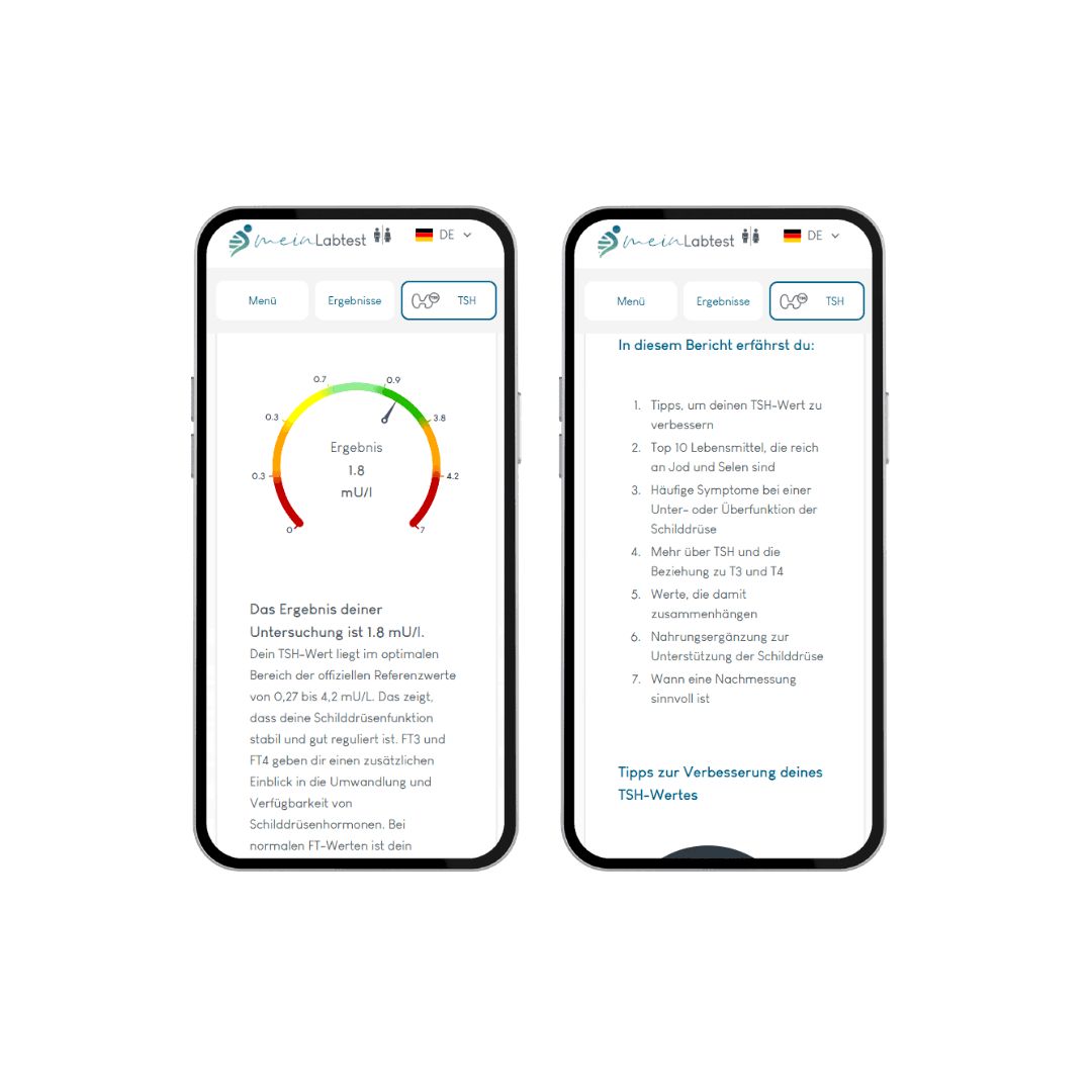 Zwei Smartphones mit Testergebnissen. Beide zeigen Diagramme und Text. Aufschrift: Ergebnisse, TSH. Informationen zur Verbesserung des TSH-Wertes.