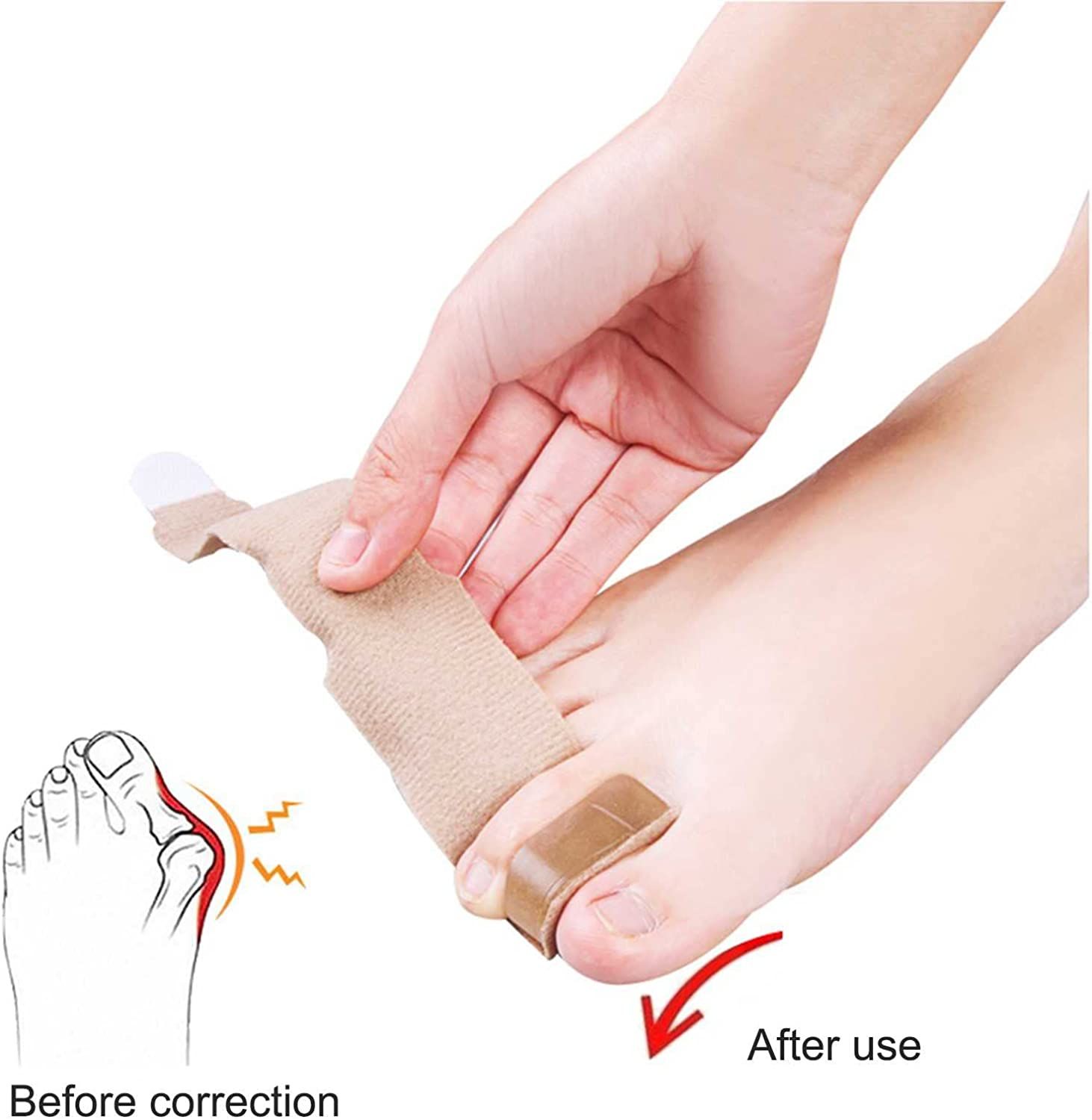 Hallux-Bandage , verstellbar & unauffällig, für Tag & Nacht, unisex tragbar