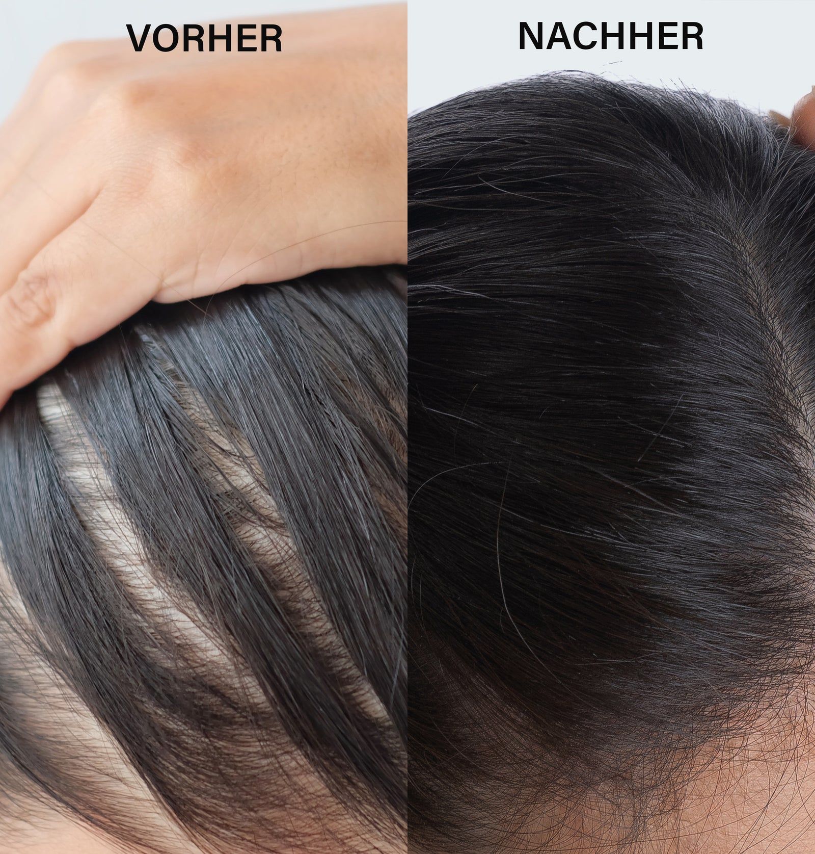 Zwei Bilder nebeneinander: Vorher und Nachher. Zeigt Kopfhaut und Haare. Schwarzes Haar.