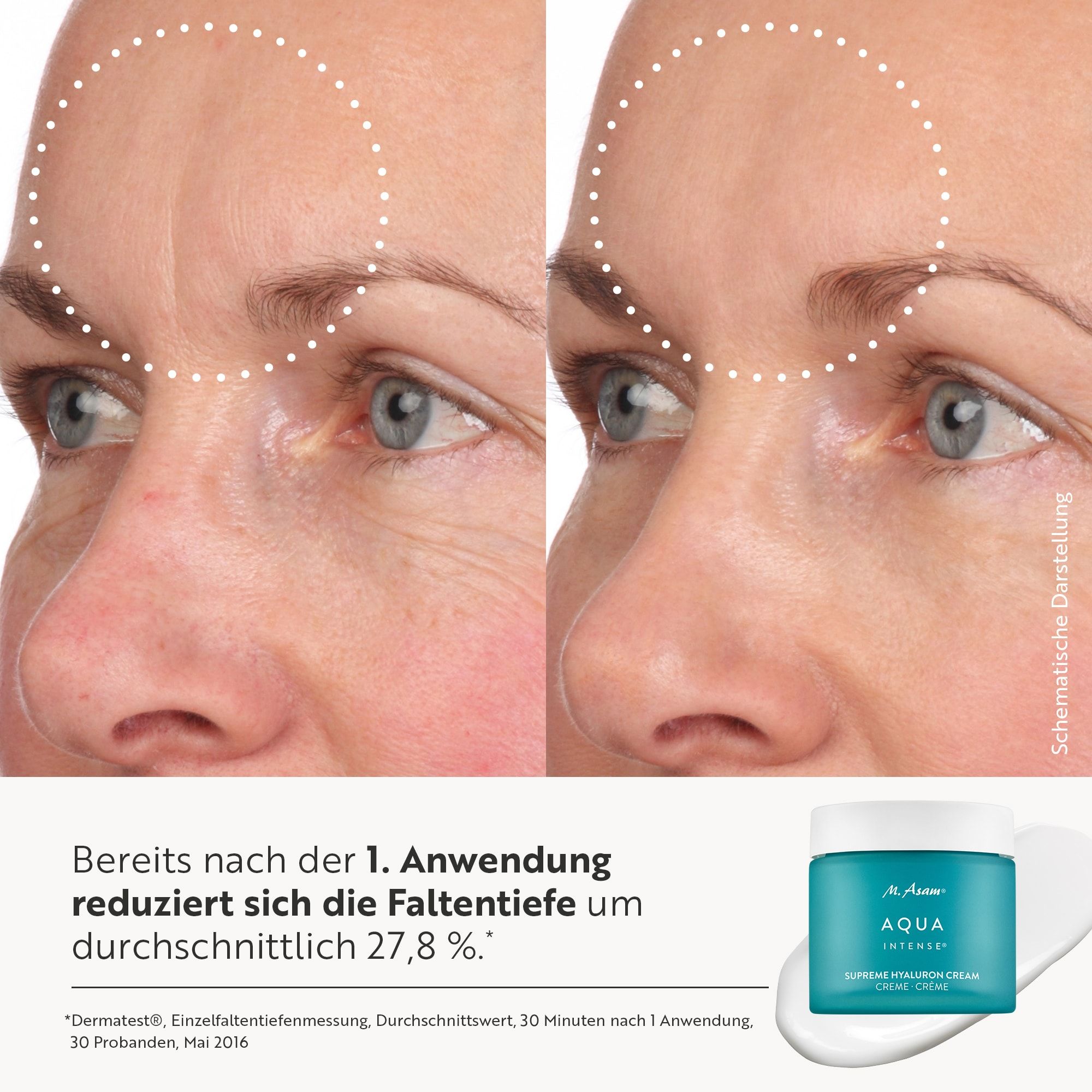 Vorher-Nachher-Vergleich der Faltentiefe im Gesicht nach Anwendung der M. Asam Aqua Intense Creme.