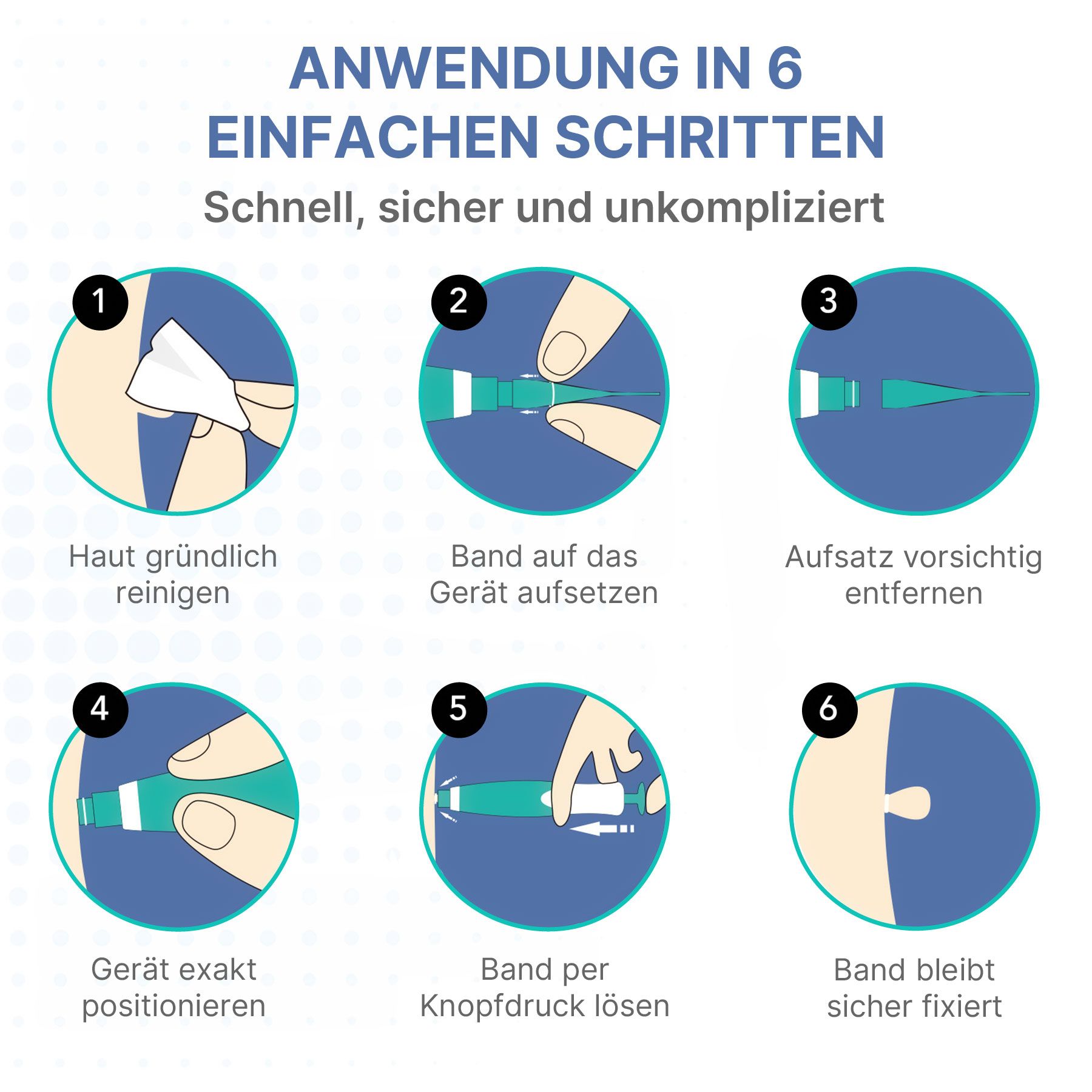 Anleitung zur Anwendung eines Hautanhängselentferners in 6 Schritten.