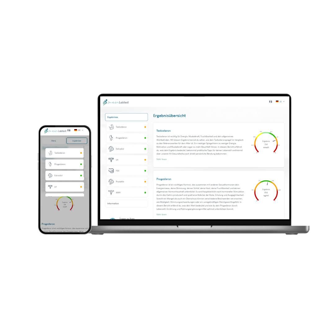 Laptop und Smartphone mit Testergebnissen. Auf dem Bildschirm: Ergebnisse, Diagramme. Logo: meinLabtest.