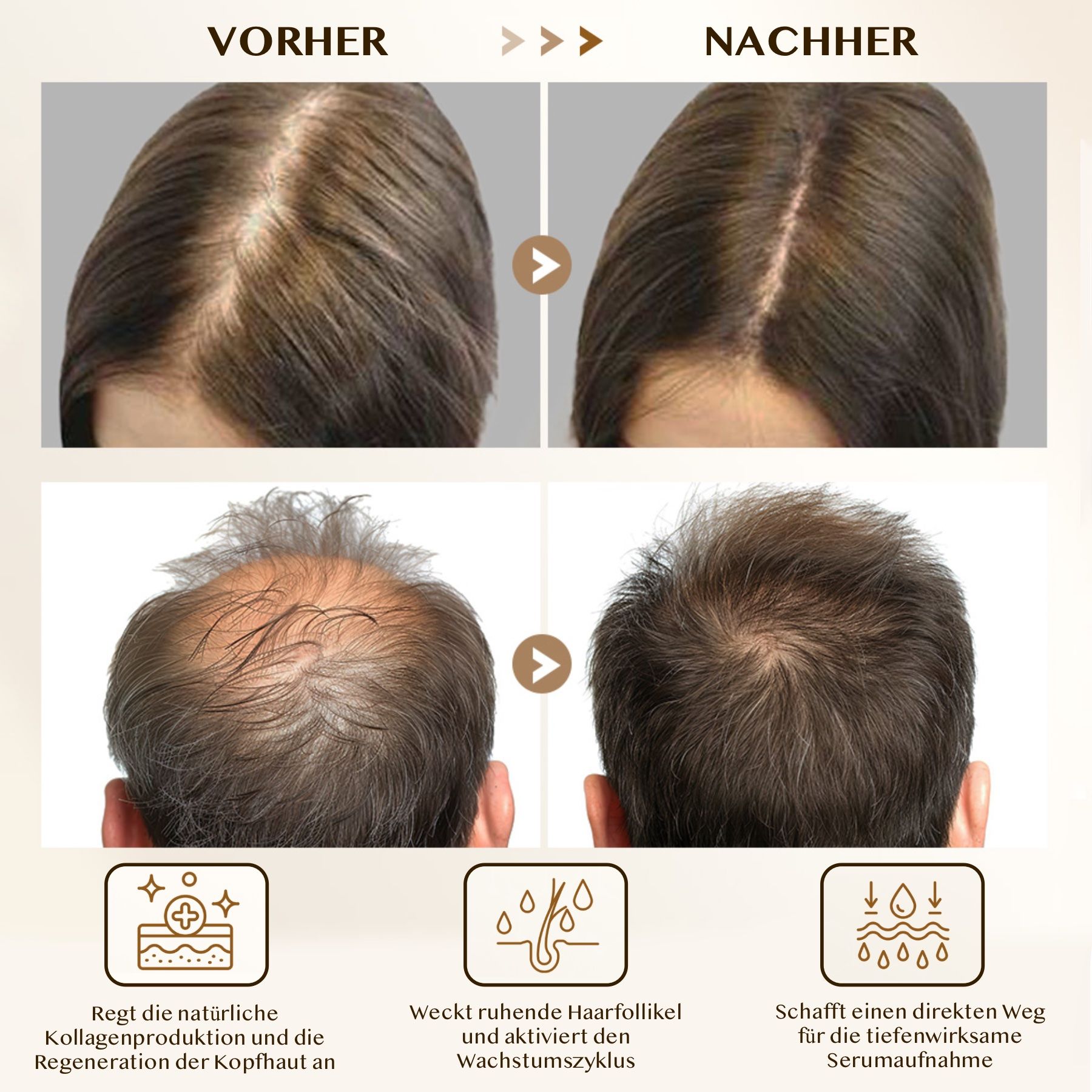 Vorher/Nachher Vergleich. Haarausfall. Dichteres Haar. Natürliche Kollagenproduktion. Haarwachstum. Serumaufnahme.