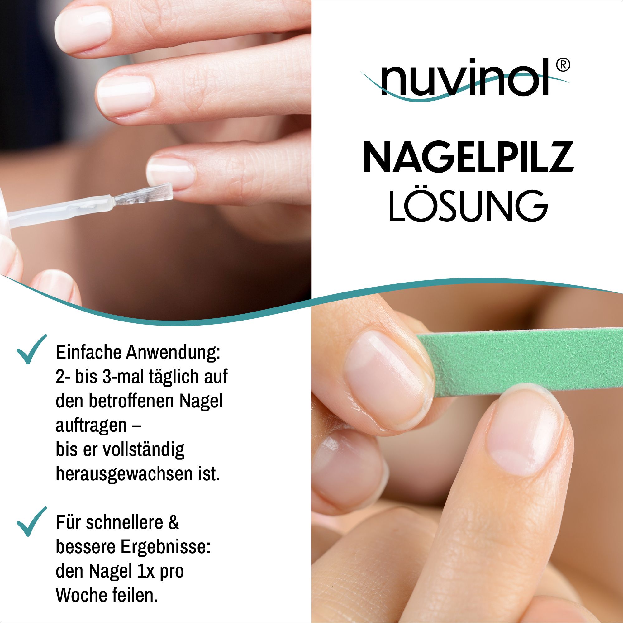 Hände mit Nagelpflege. Flasche und Text: Nuvinol Nagelpilz Lösung. Einfache Anwendung, 2-3 mal täglich auftragen, Nägel feilen.