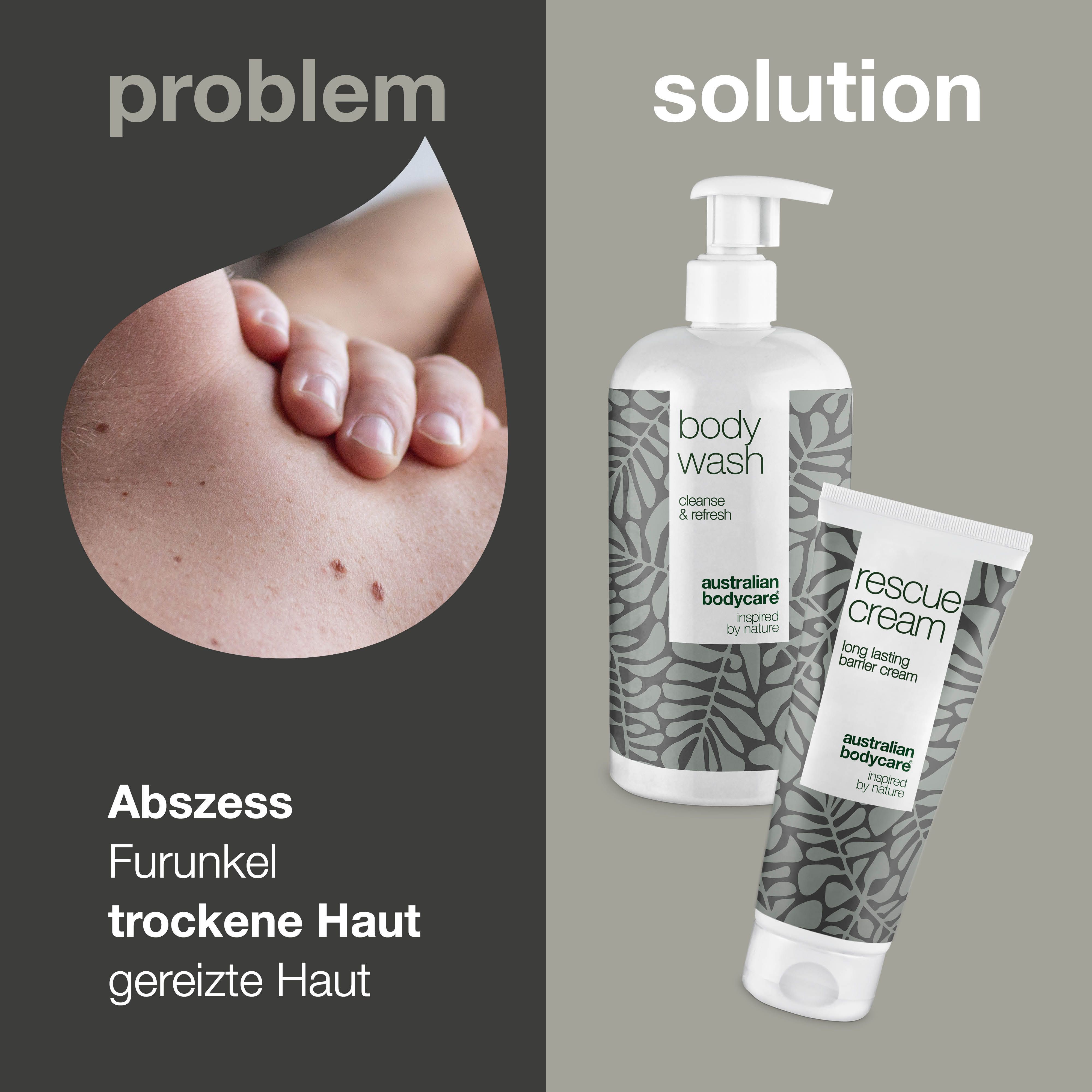 Problem: Haut mit Pickeln. Lösung: Body Wash und Rescue Cream. Text: Abszess, Furunkel, trockene Haut, gereizte Haut.