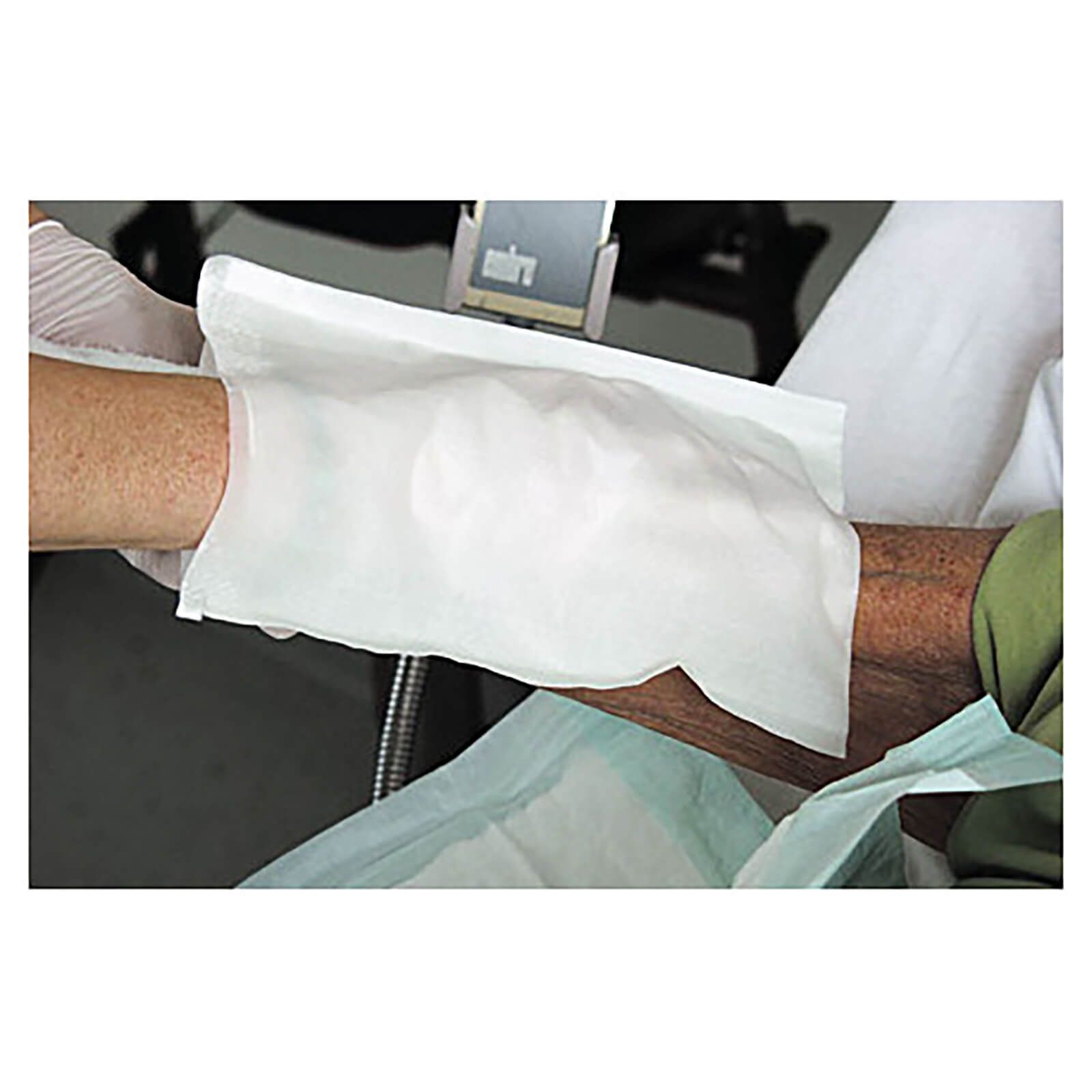 Weißer Waschhandschuh mit Folie auf Arm. Person trägt Handschuh. Hintergrund: medizinische Umgebung.