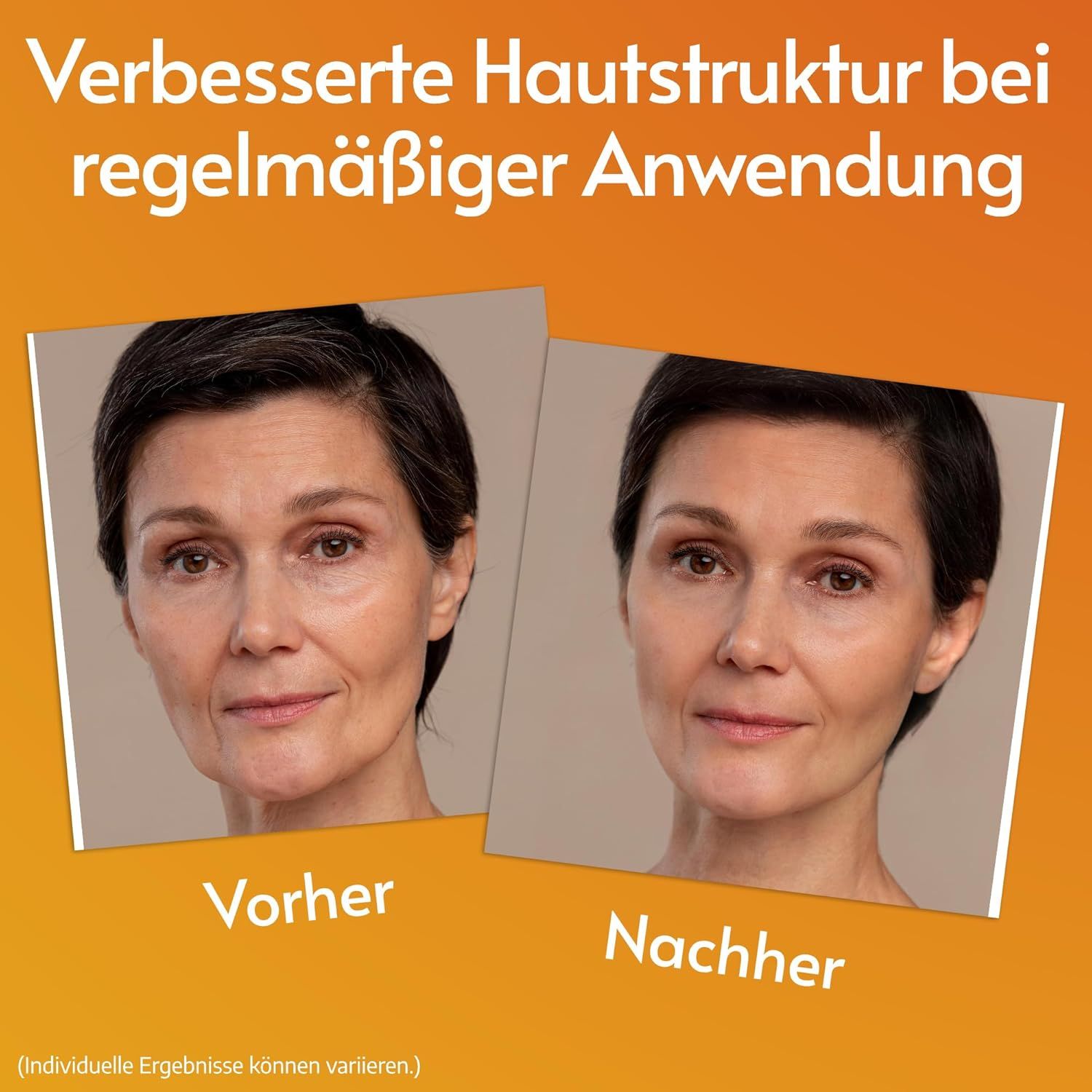 Vorher-Nachher-Vergleich. Frau mit Hautbildverbesserung. Text: Verbesserte Hautstruktur bei regelmäßiger Anwendung.
