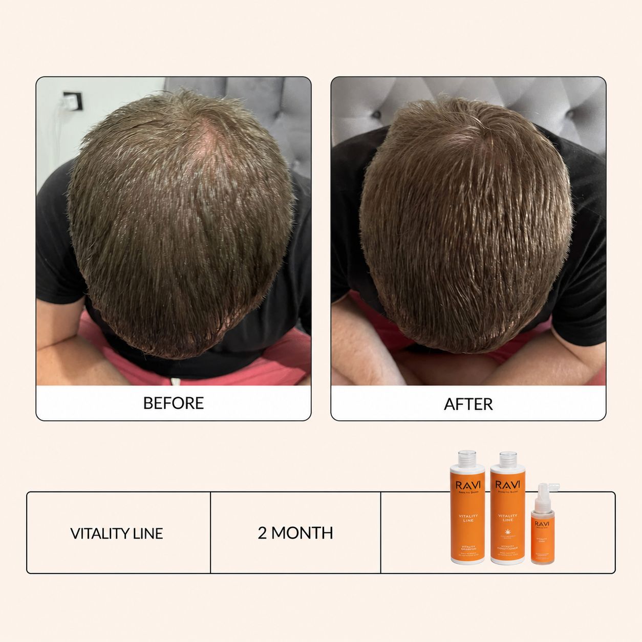 Vorher-Nachher-Vergleich von Haaren nach 2 Monaten mit RAVI Vitality Line.
