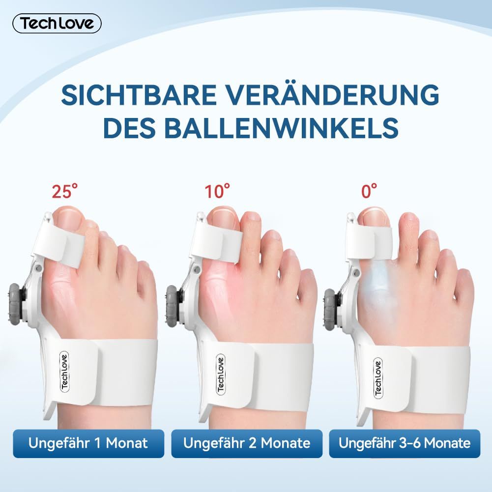 Eine Infografik, die die sichtbare Veränderung des Ballenwinkels mit dem Tech Love Korrektor zeigt. Sie zeigt drei Stadien der Korrektur über einen Zeitraum von 1 bis 6 Monaten. Der Korrektor wird am Fuß getragen und hat einen Drehknopf.