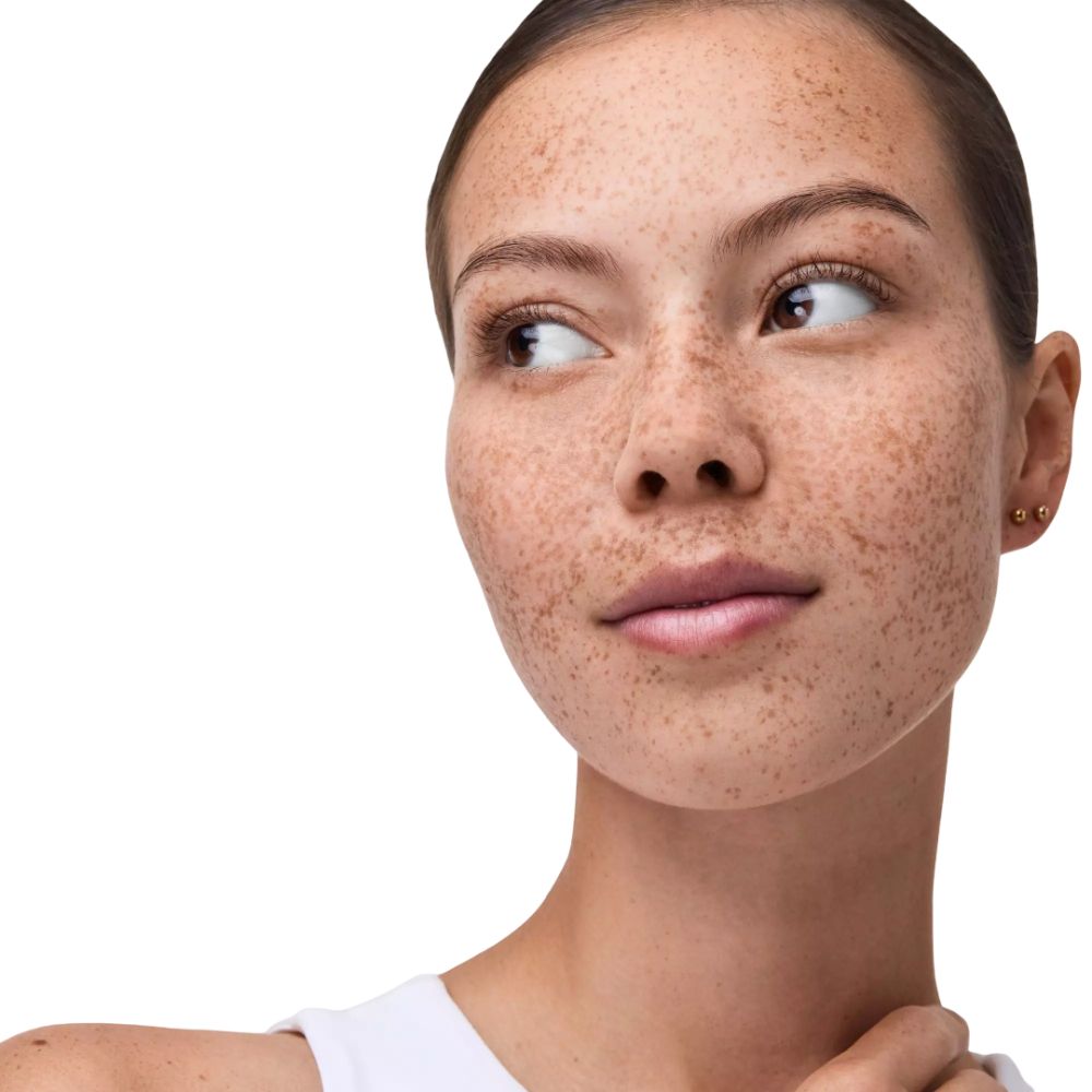 Nahaufnahme eines Gesichts mit Sommersprossen. Person blickt zur Seite.