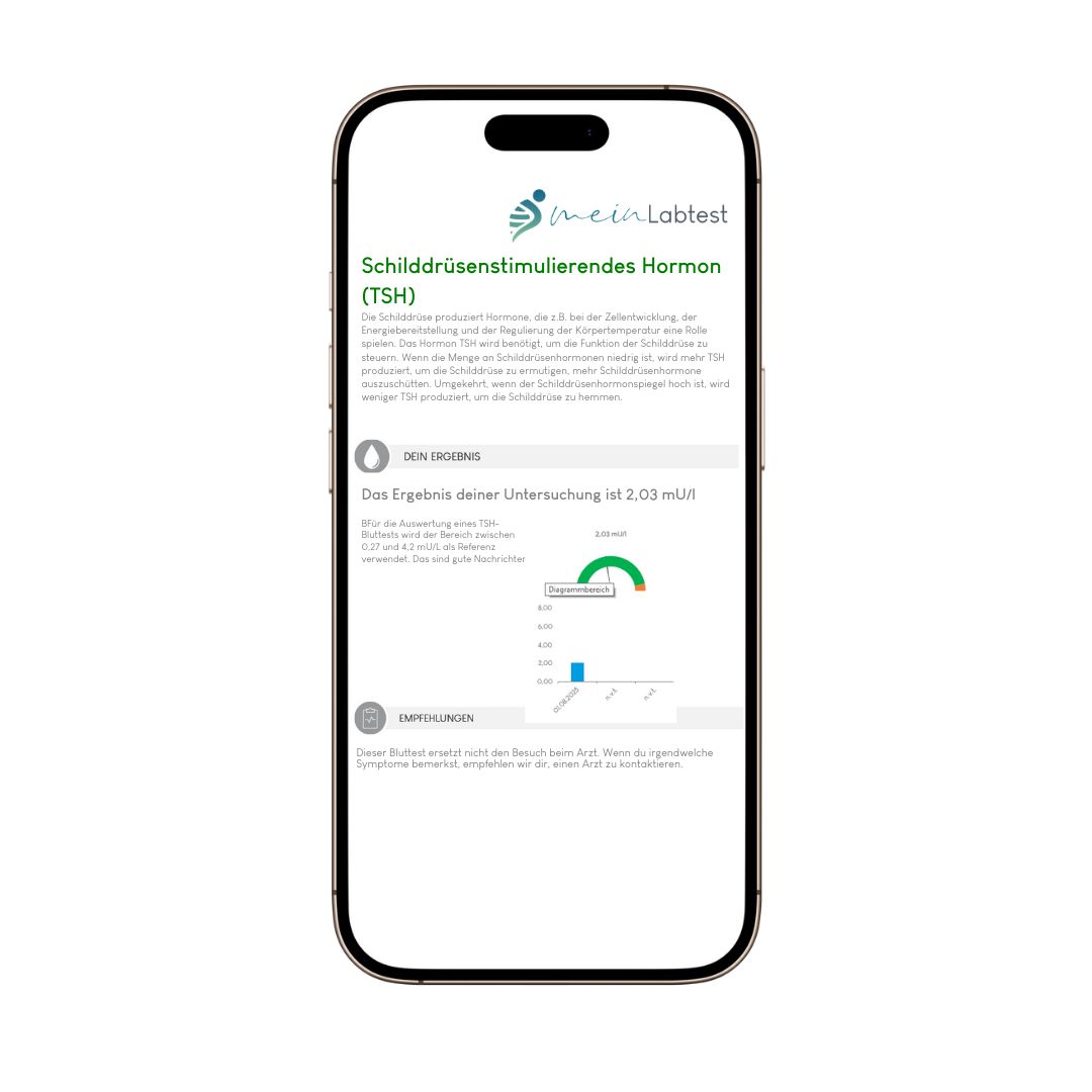 Smartphone mit Testergebnis: Schilddrüsenstimulierendes Hormon (TSH). Diagramm und Text. Logo: meinLabtest.