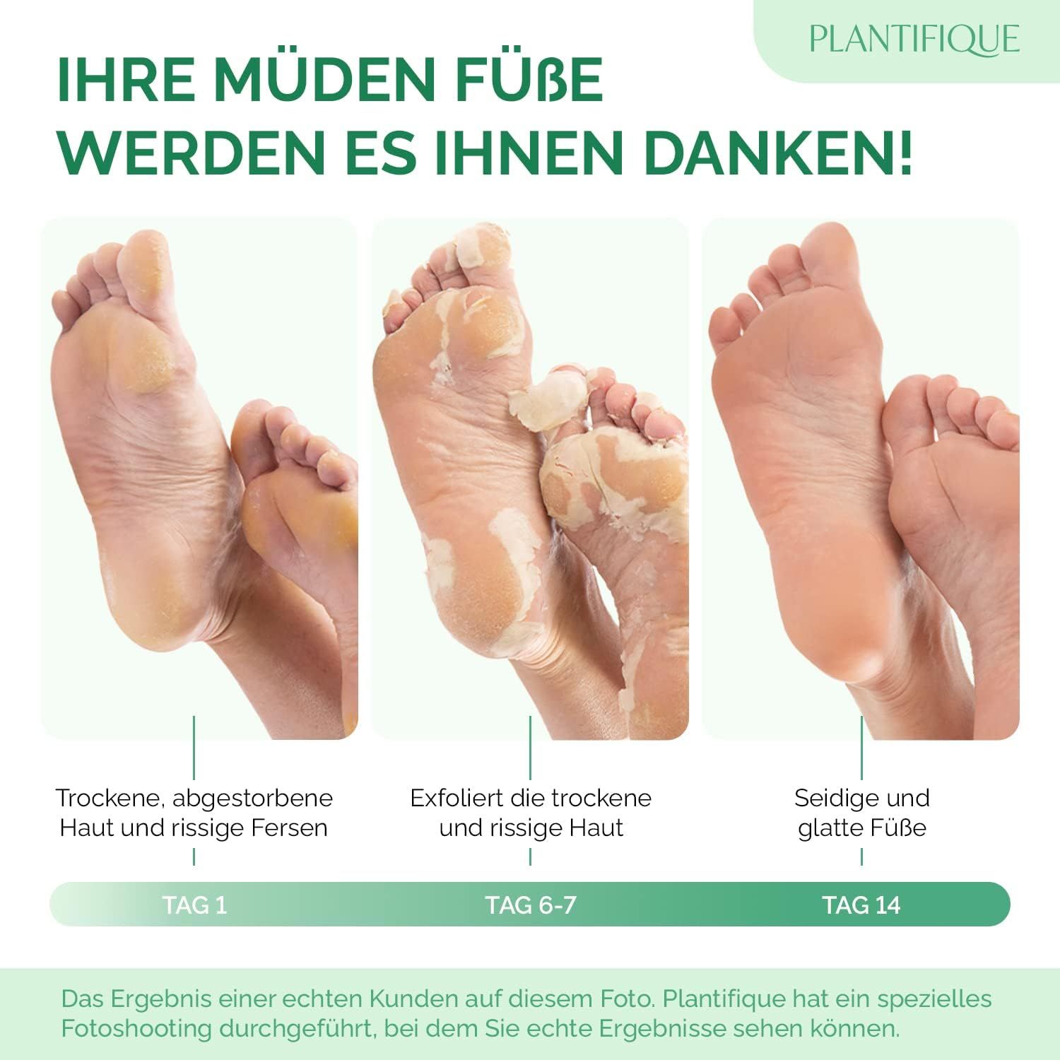 Fußmaske - Hornhaut Socken - Fussmaske Vitamine 2 Paar Hornhautentferner Socken