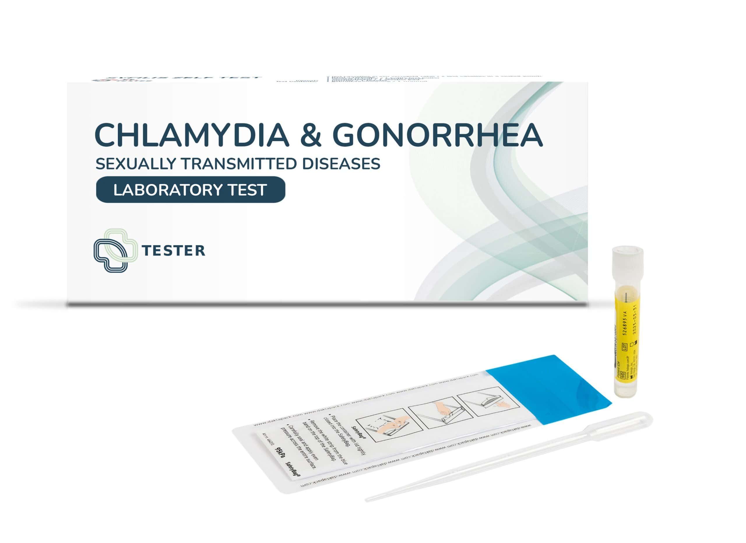 Chlamydien- & Gonorrhoe-Test-Kit mit Laborröhrchen, Pipette und Teststreifen.