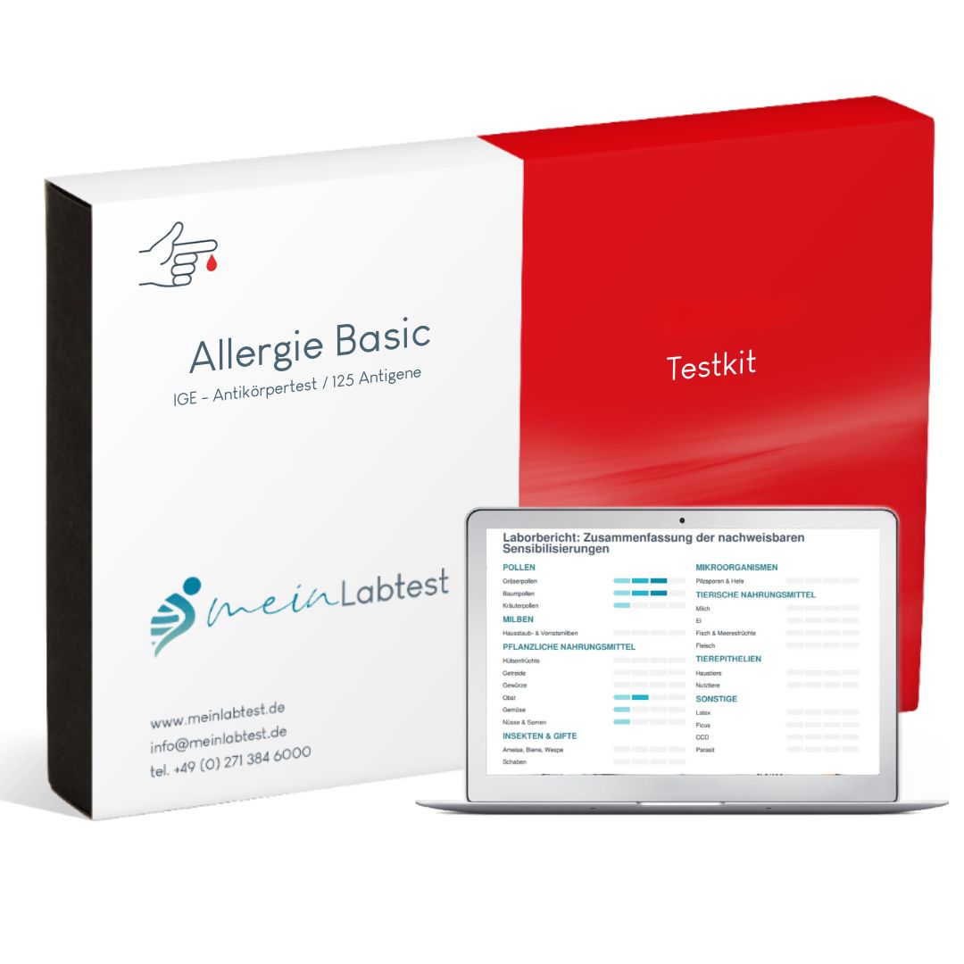 Allergietest Basic-Kit. Weiß-roter Karton mit Logo und Text. Laptop mit Testergebnissen.