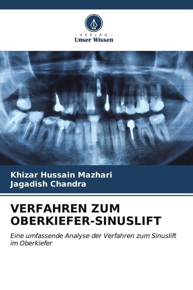 VERFAHREN ZUM OBERKIEFER-SINUSLIFT Eine umfassende Analyse der Verfahren zum Sinuslift im Oberkie...