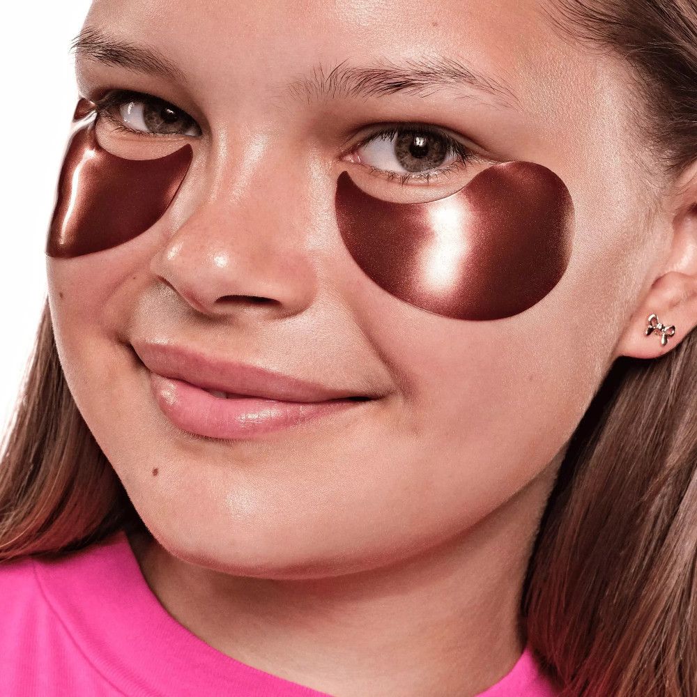 Braune Augenpads auf der Haut unter den Augen einer jungen Frau.