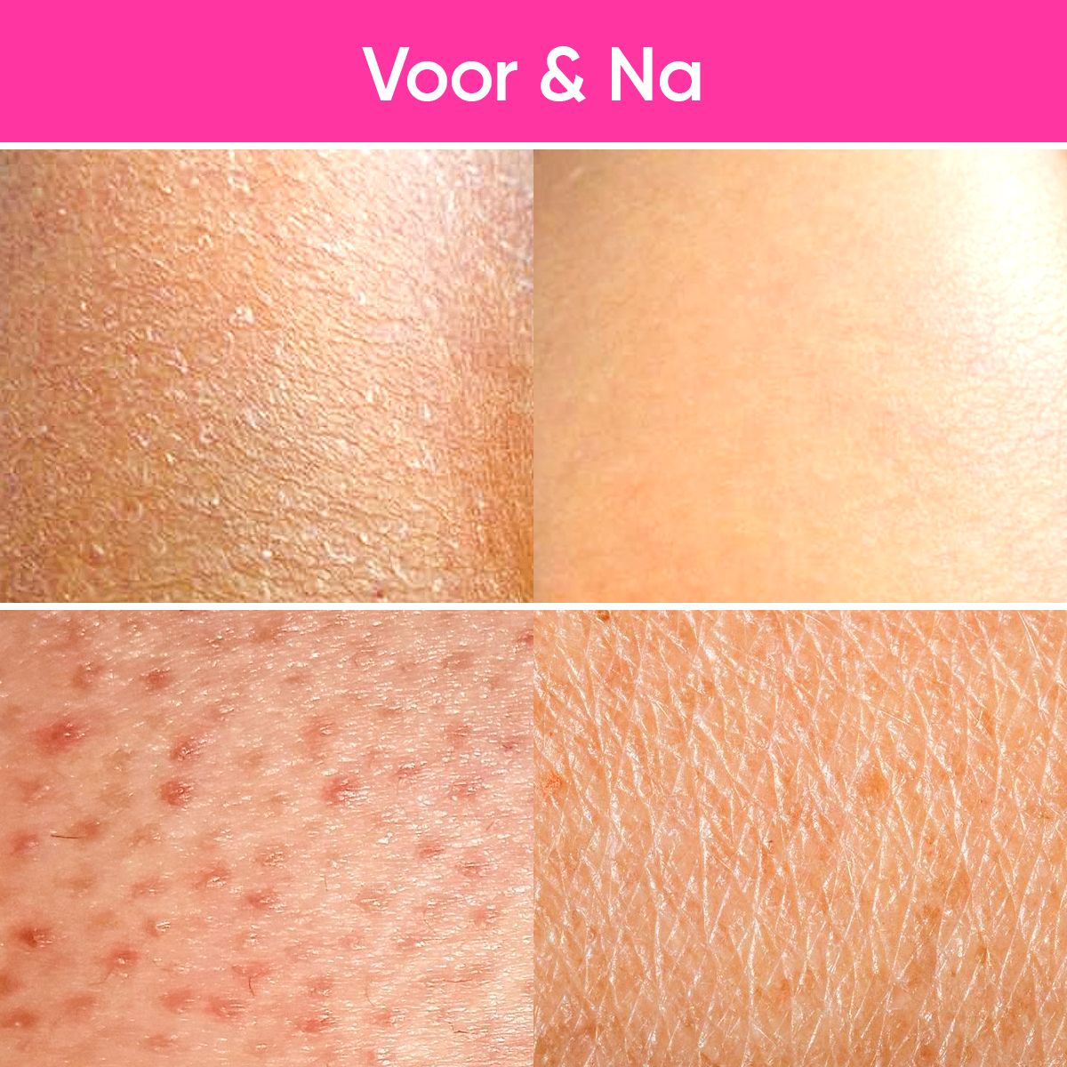 Voor- en na-vergelijking. Huid met en zonder toepassing.