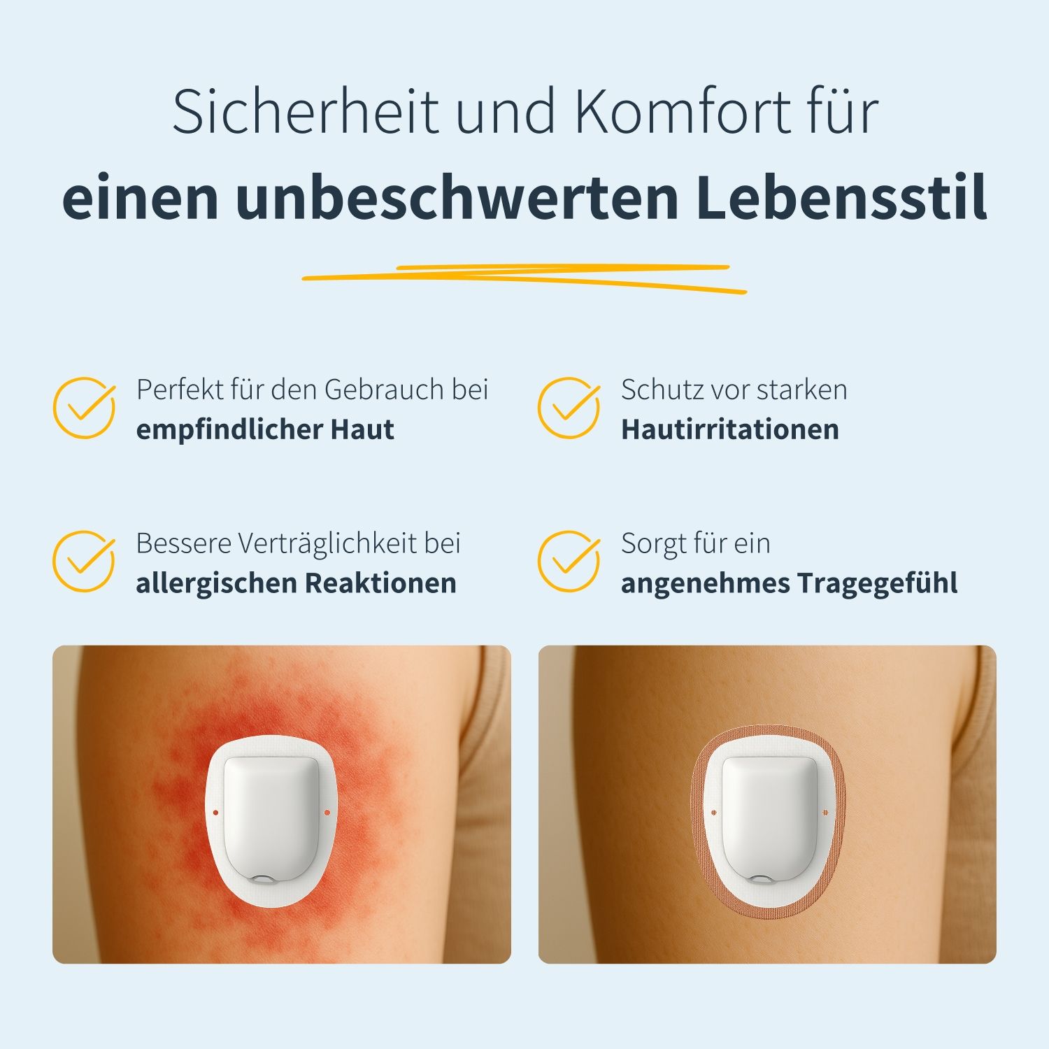 Vergleich zweier Hautstellen. Links: Hautirritation. Rechts: Omnipod mit Pflaster, ohne Irritation.