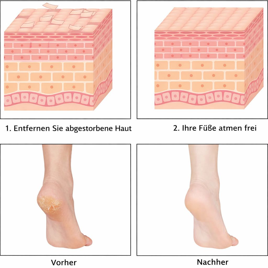 Hornhautfeile Set Edelstahl, Fußschaber & Feile mit 10 Klingen für Pediküre & Fußpflege