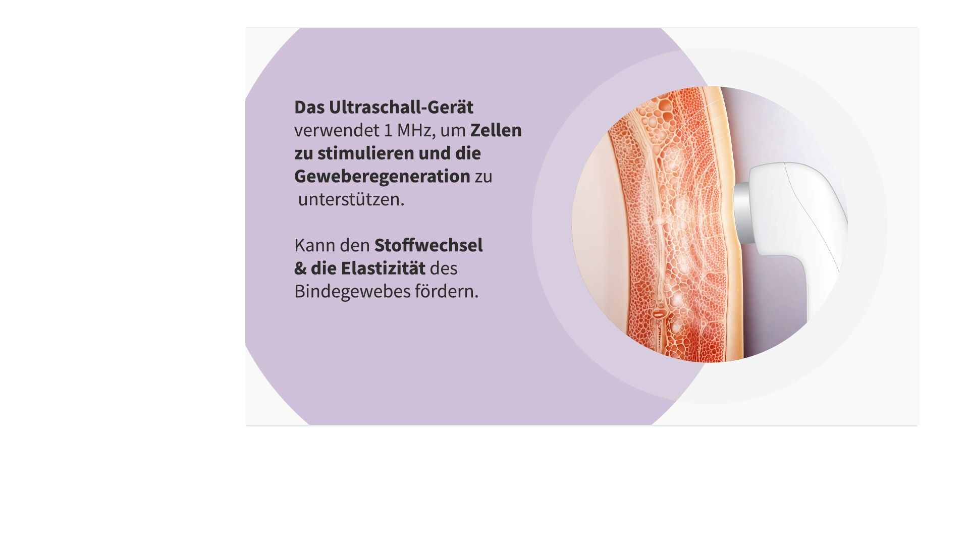 Schema der Ultraschall-Wellenwirkung auf Hautschichten.