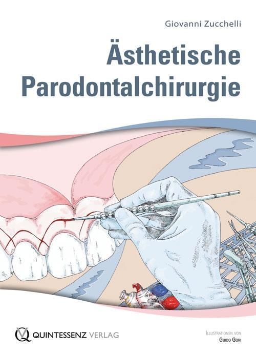 Ästhetische Parodontalchirurgie, Buch + Lehrtafeln 2 Bde in Kassette