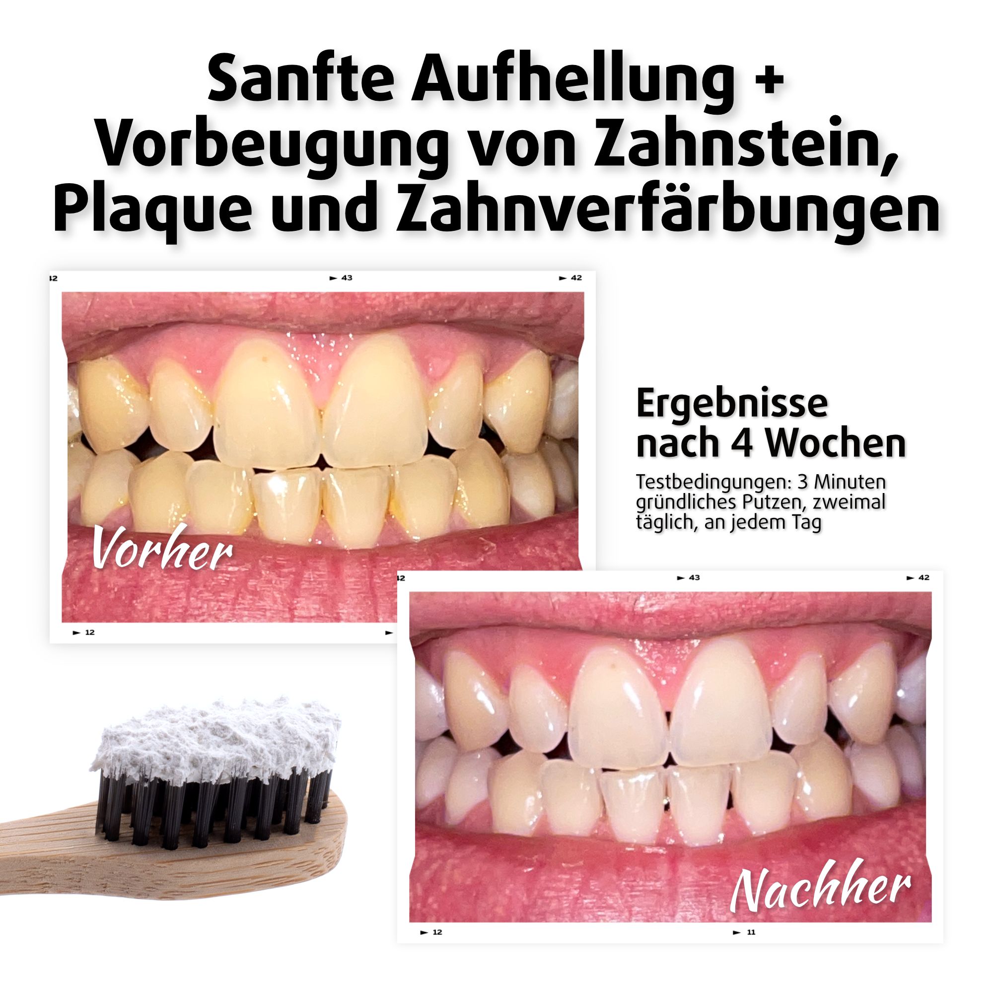 Zähne Vorher-Nachher-Vergleich. Zähne mit Zahnbürste. Text: Ergebnisse nach 4 Wochen.