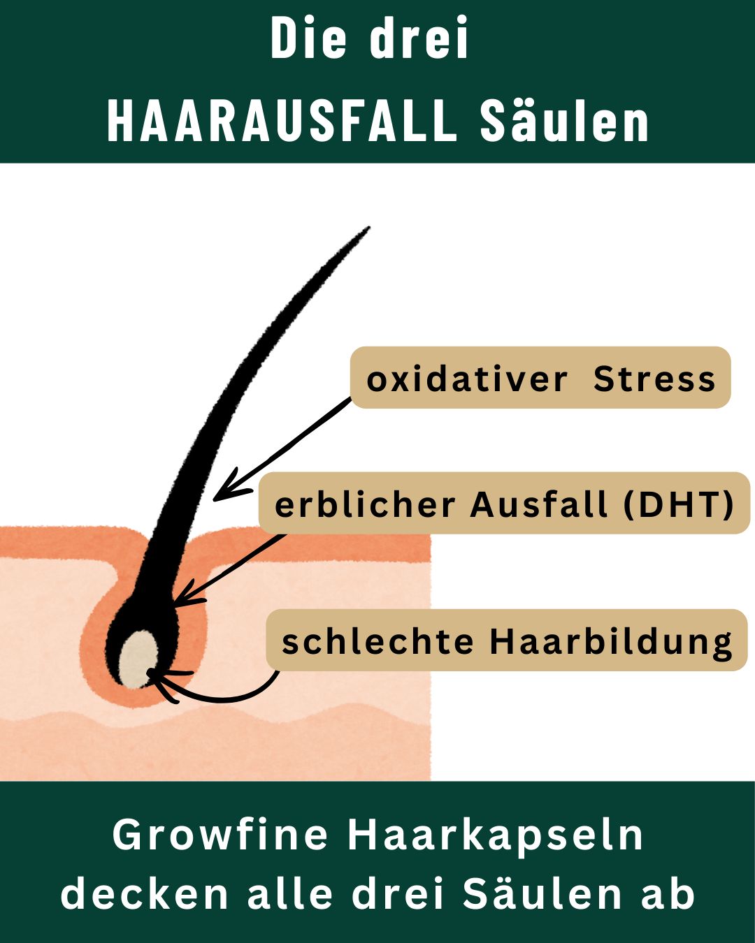 Diagramm der drei Ursachen für Haarausfall: oxidativer Stress, erblicher Ausfall (DHT), schlechte Haarbildung. Growfine® Haarkapseln.