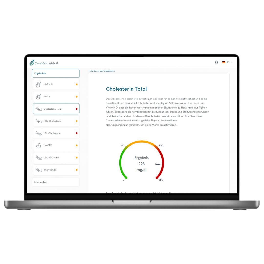 Laptop mit Testergebnissen. Auf dem Bildschirm: Diagramme und Text. Logo: meinLabtest. Cholesterin Total-Anzeige.