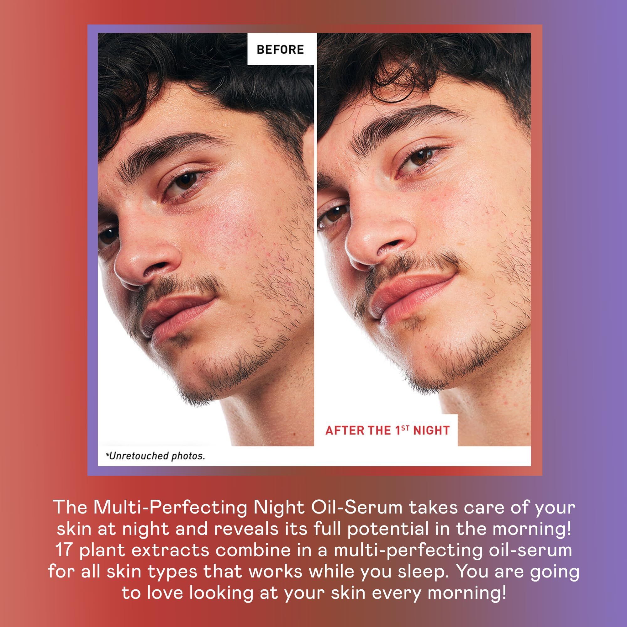 Vorher-Nachher-Vergleich. Zwei Gesichter, links vorher, rechts nach der Anwendung. Text: 'Multi-Perfecting Night Oil-Serum'.