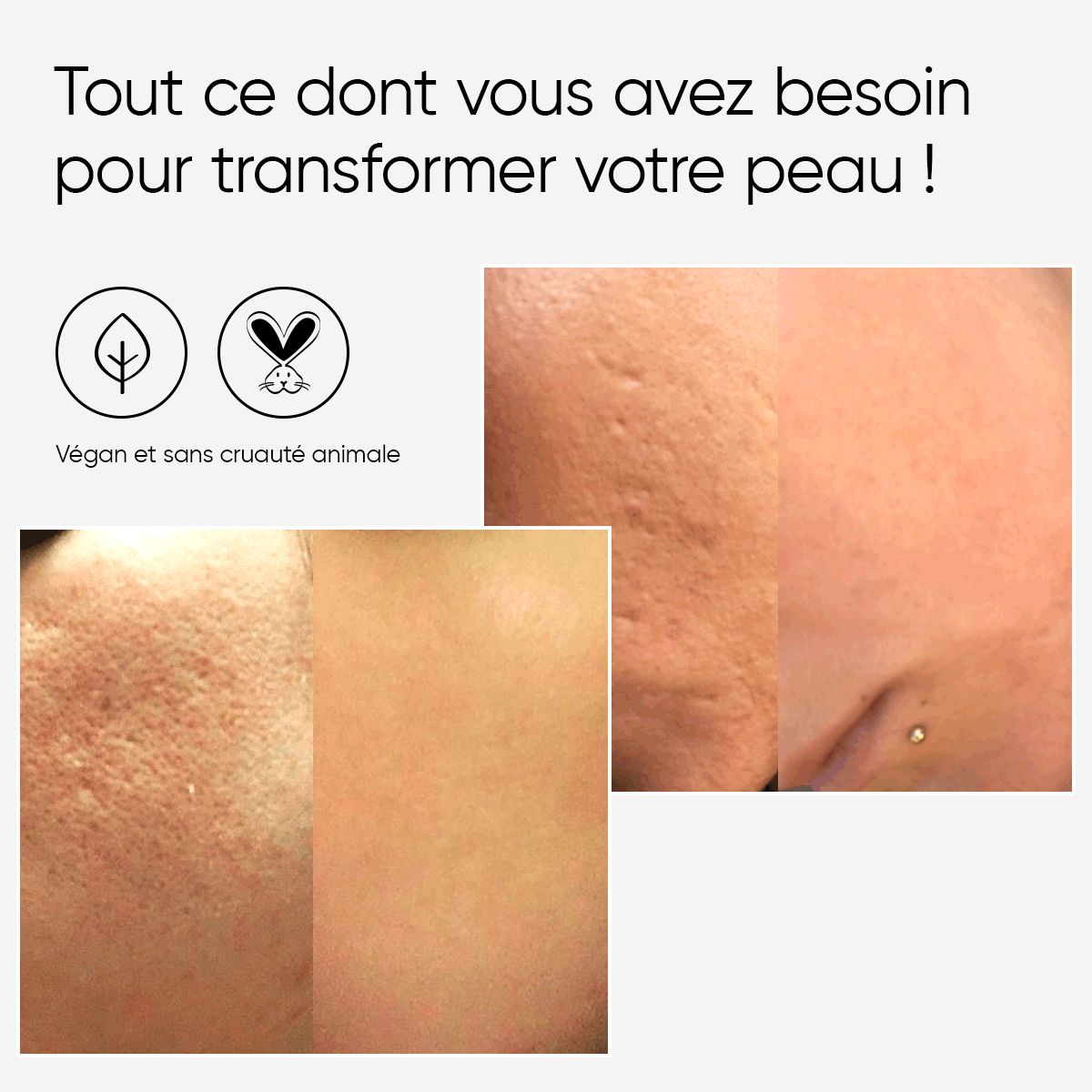 Images avant-après de la peau. Texte sur les produits végétaliens et sans cruauté.