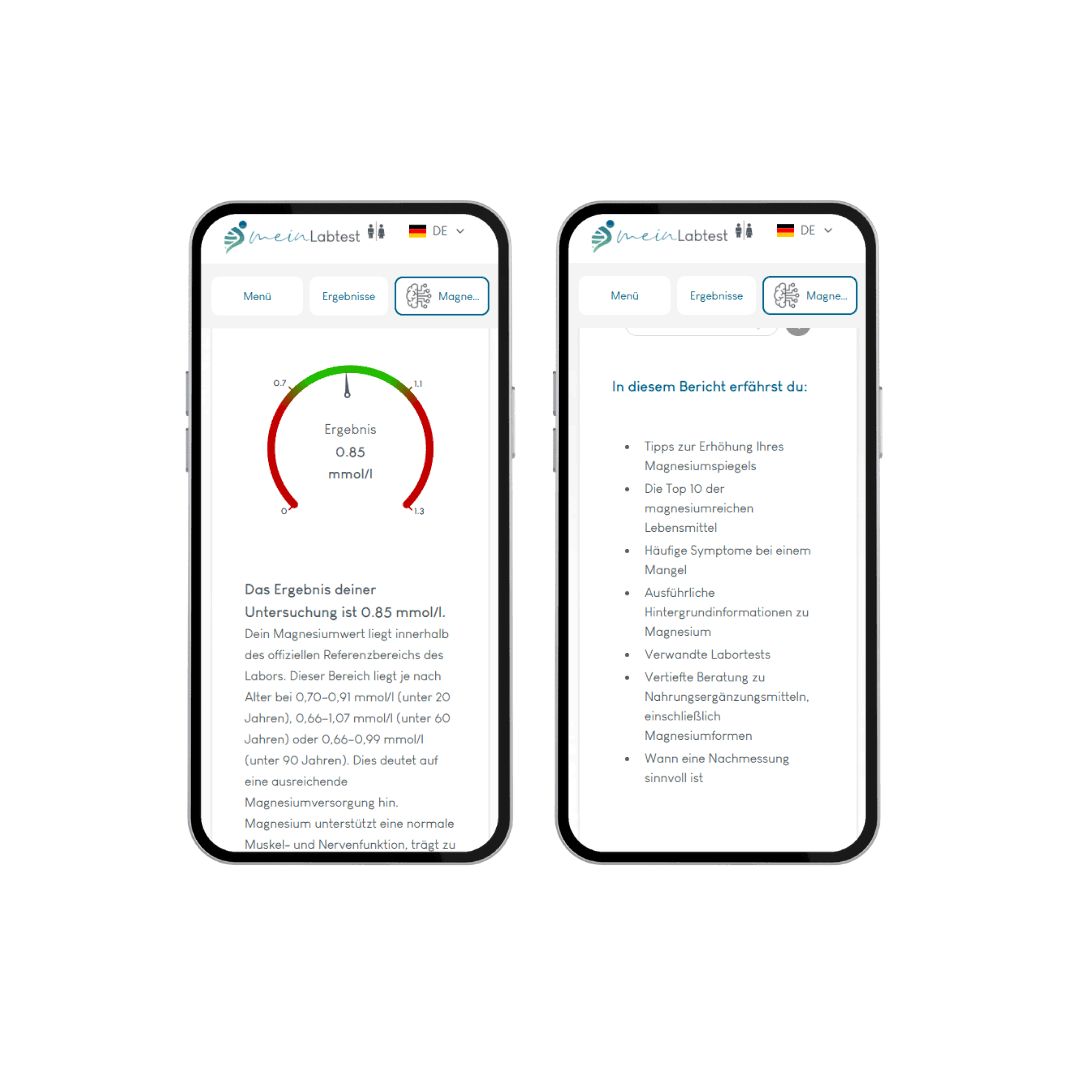 Zwei Smartphones mit Testergebnissen. MeinLabtest-Logo. Magnesium-Informationen und Ergebnis-Anzeige.