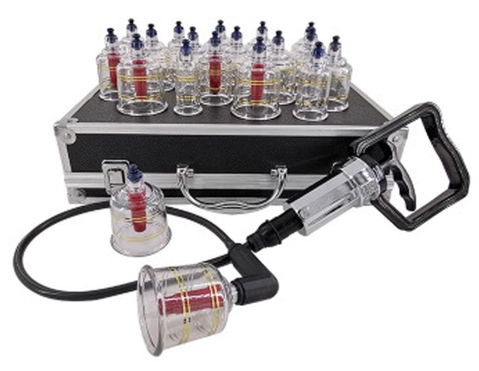 Schröpfgläser-Set mit Pumpe und Koffer. Mehrere Glasglocken mit roter Markierung, Pumpe mit Griff und Schlauch.