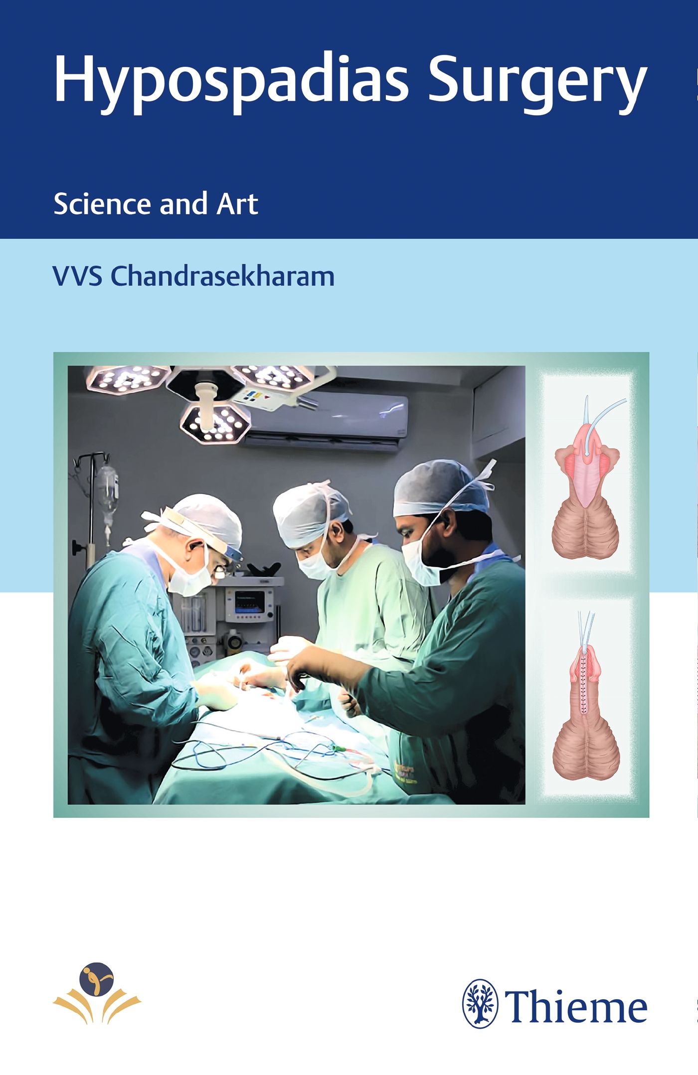 Buchcover: "Hypospadias Surgery". Ärzte bei Operation. Illustrationen. Logo Thieme.