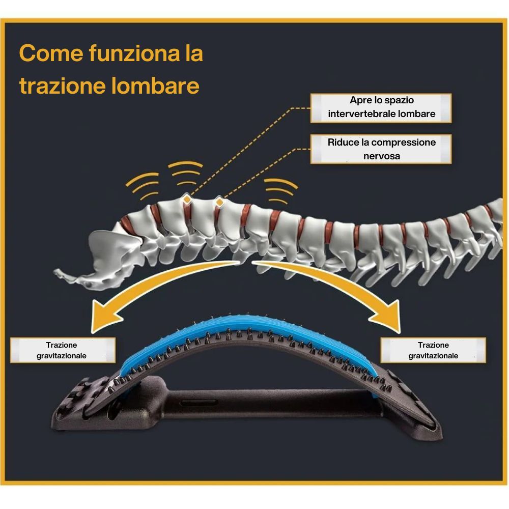 Dispositivo per l'allungamento della schiena con punti di digitopressione. Parte in plastica nera con supporto blu. Illustrazione della colonna vertebrale.