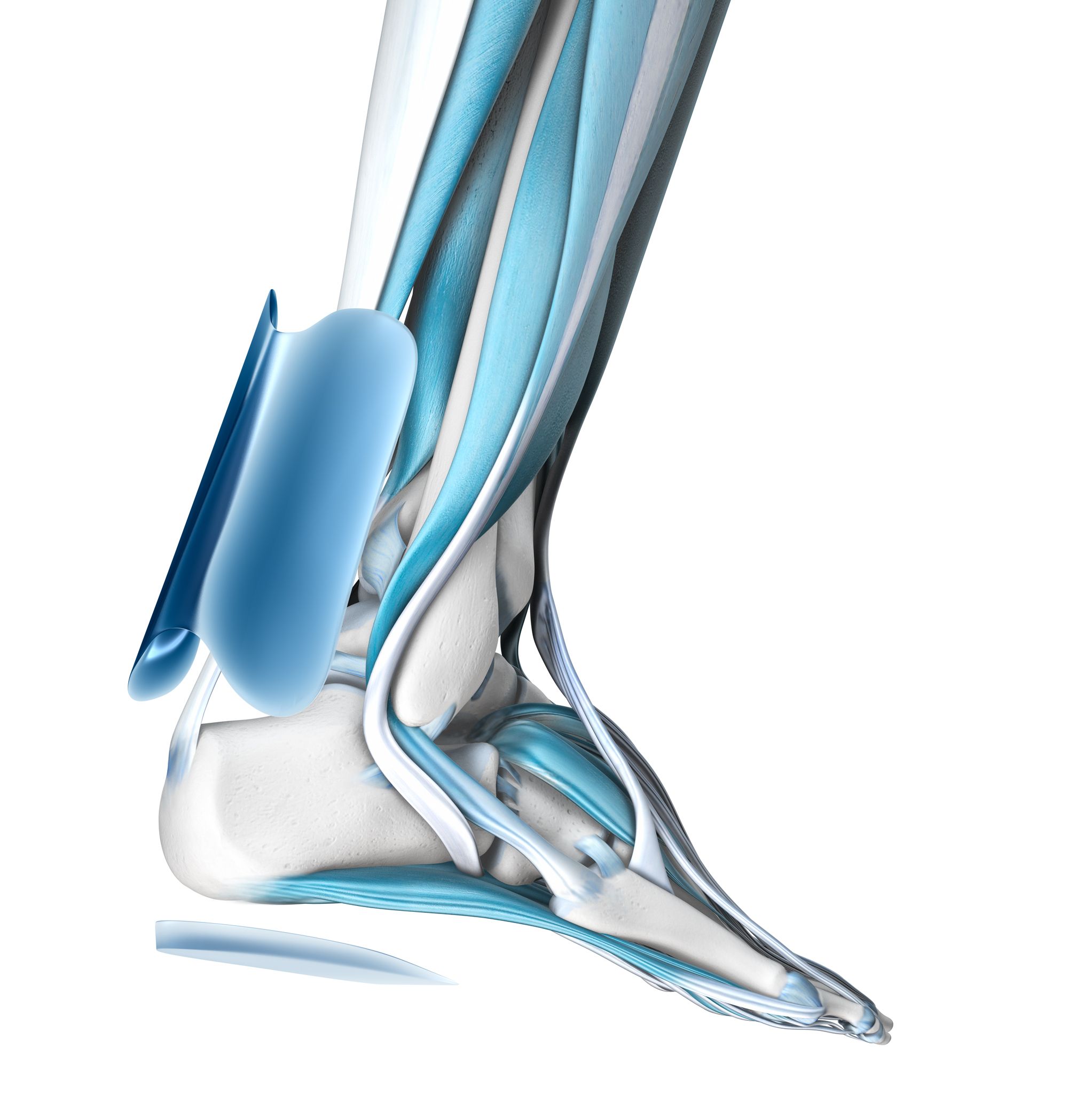 Anatomische Darstellung des Knöchels mit einer blauen Achillessehnen-Bandage. Muskeln und Knochen sind sichtbar.