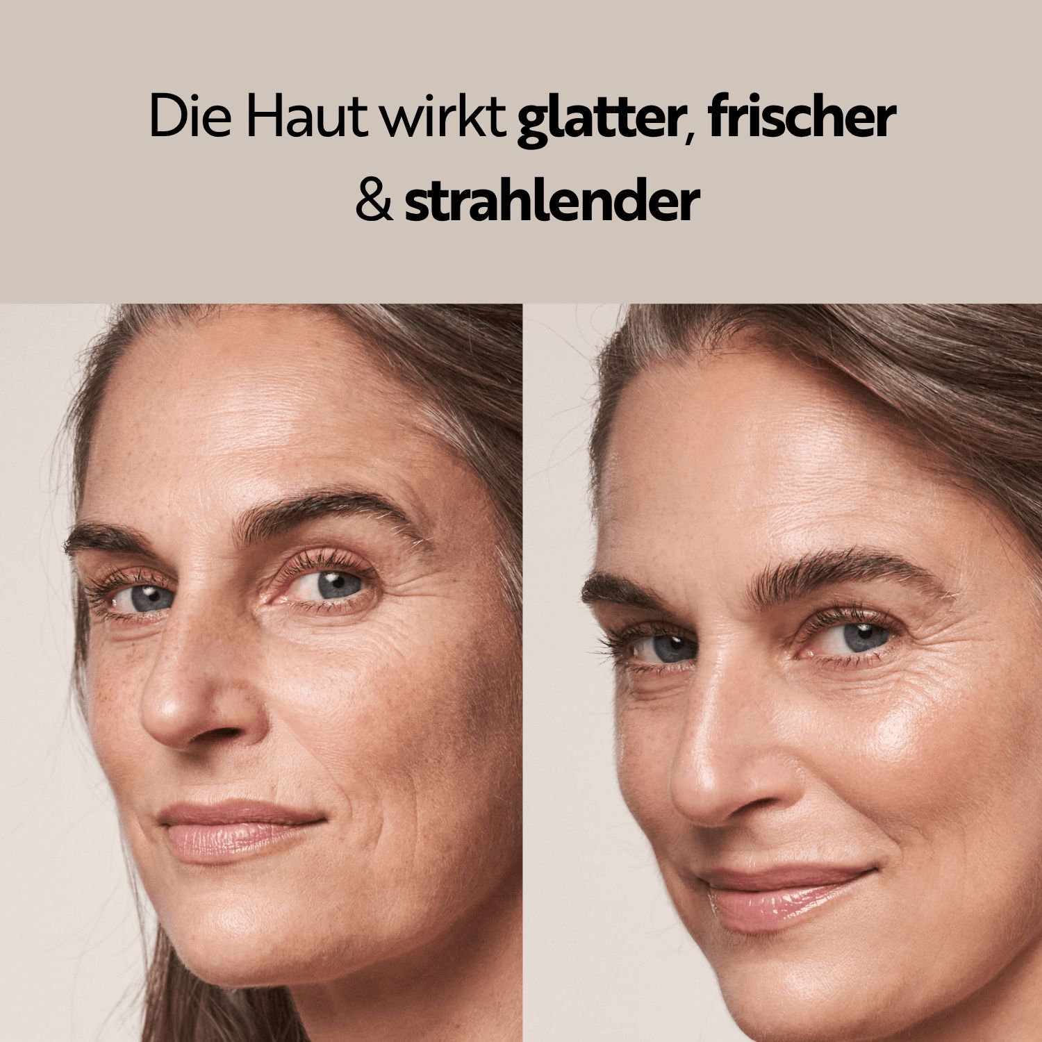 Vorher-Nachher-Vergleich einer Frau, deren Haut nach Anwendung der M. Asam Lifting Gesichtscreme glatter und strahlender wirkt.