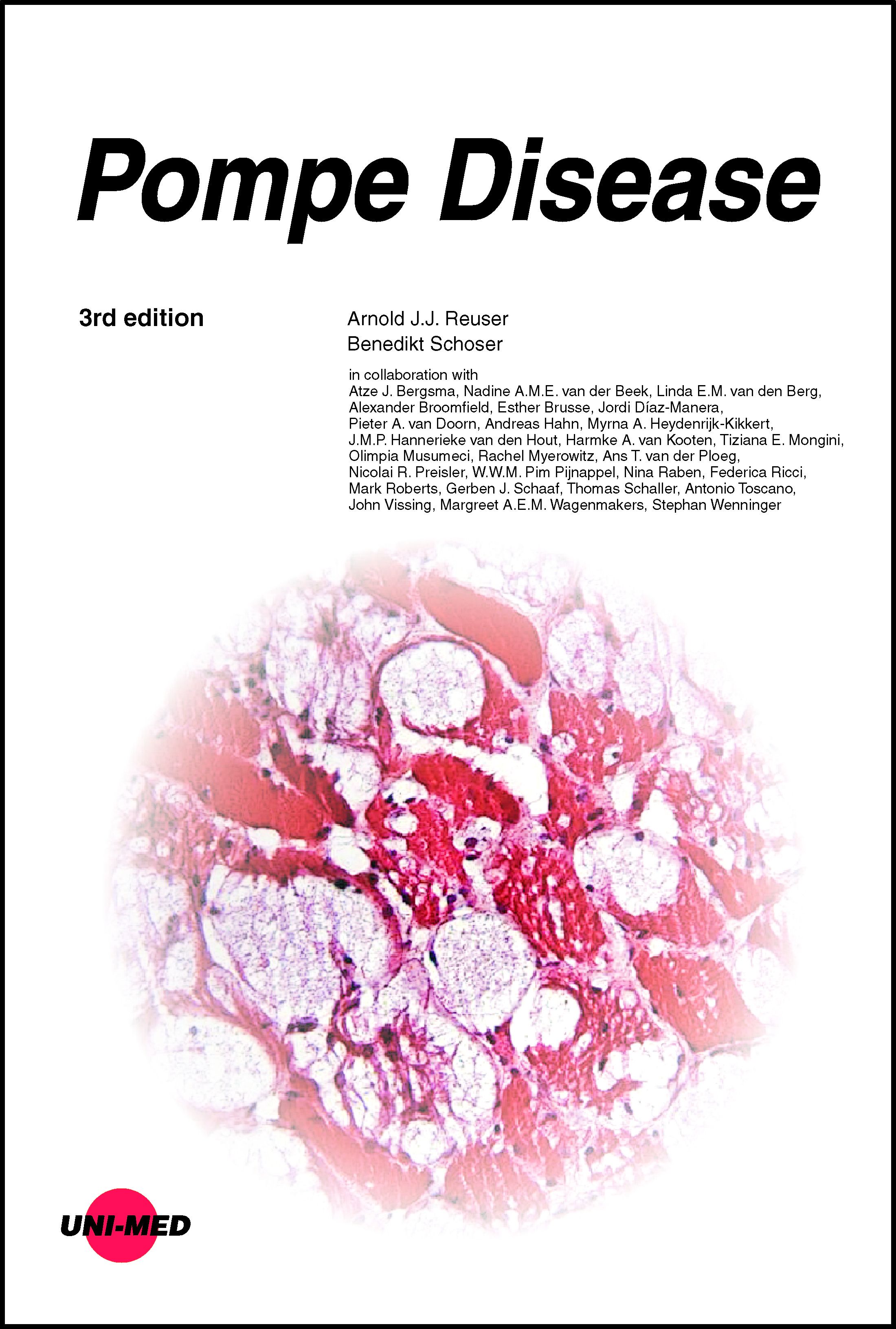 Buchcover mit Titel "Pompe Disease". Autoren und Mitwirkende sind aufgelistet. Im Hintergrund ein mikroskopisches Bild.