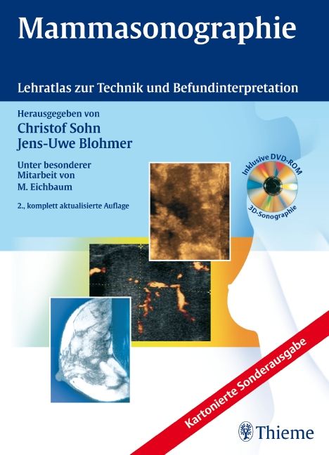 Buchcover: Mammasonographie. Lehratlas zur Technik und Befundinterpretation. Mit DVD-ROM. Verlag Thieme.