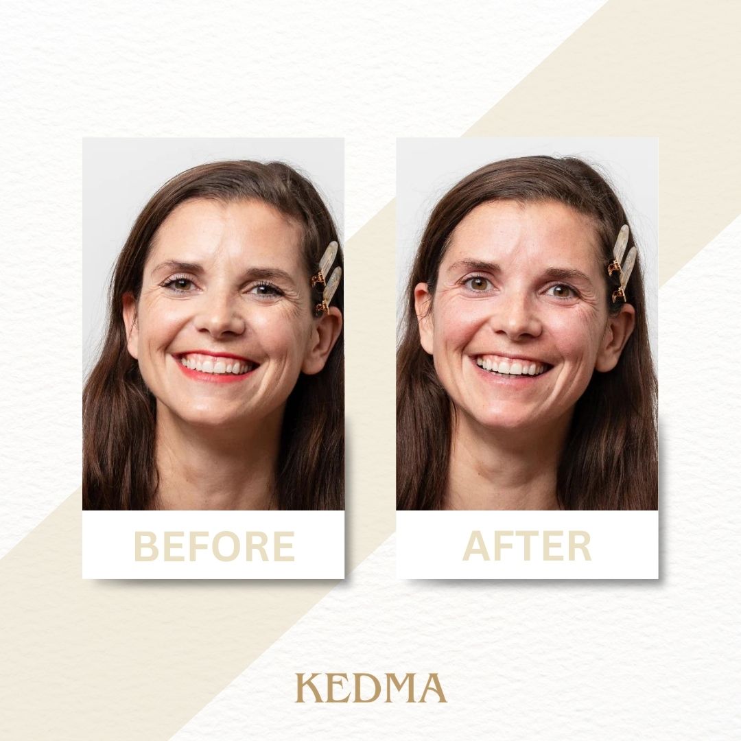 Kedma - Make-up Entferner mit Jojobaöl & Vitamin E