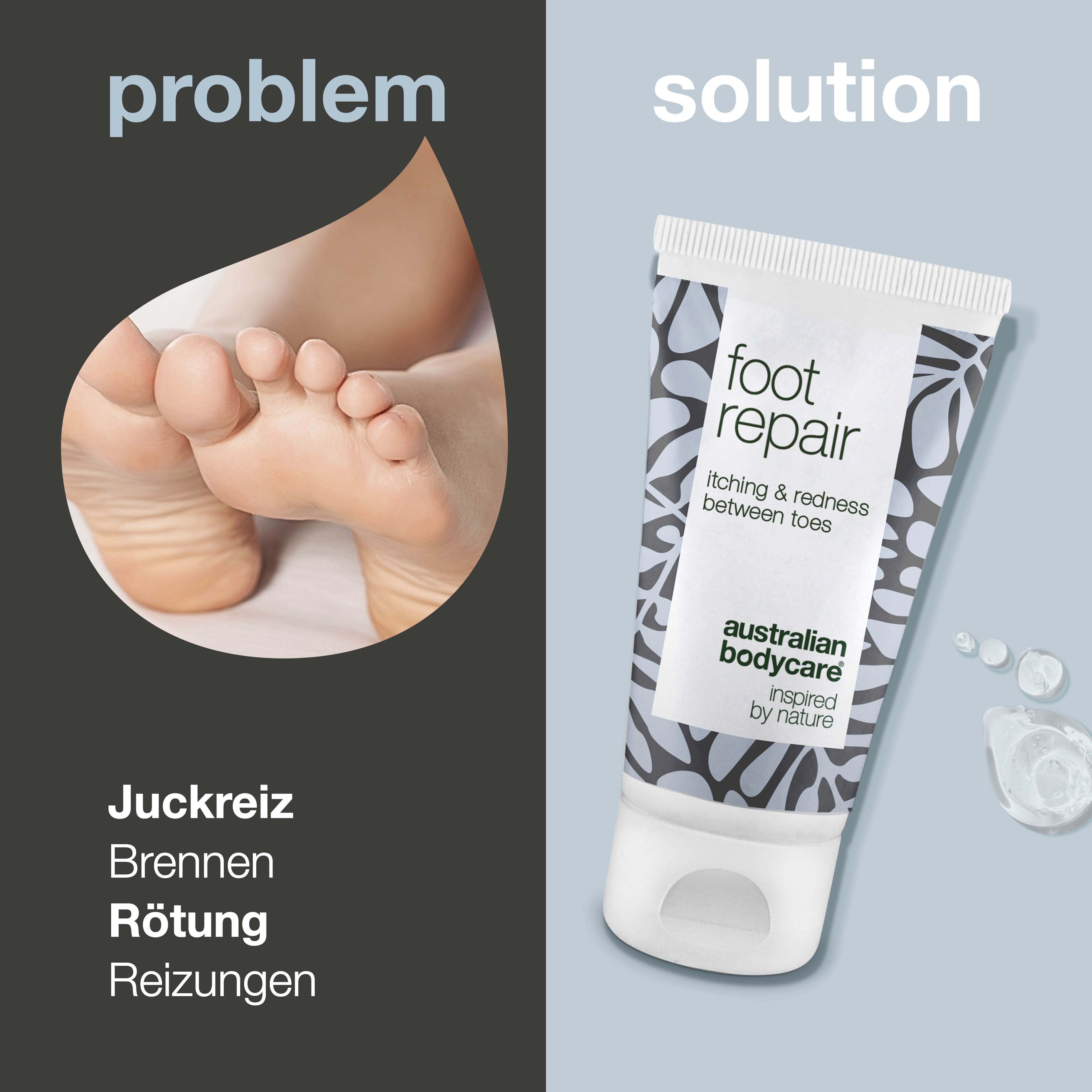 Fuß mit Juckreiz, Brennen, Rötung. Fußpflege-Tube: foot repair, itching & redness between toes, Australian Bodycare.