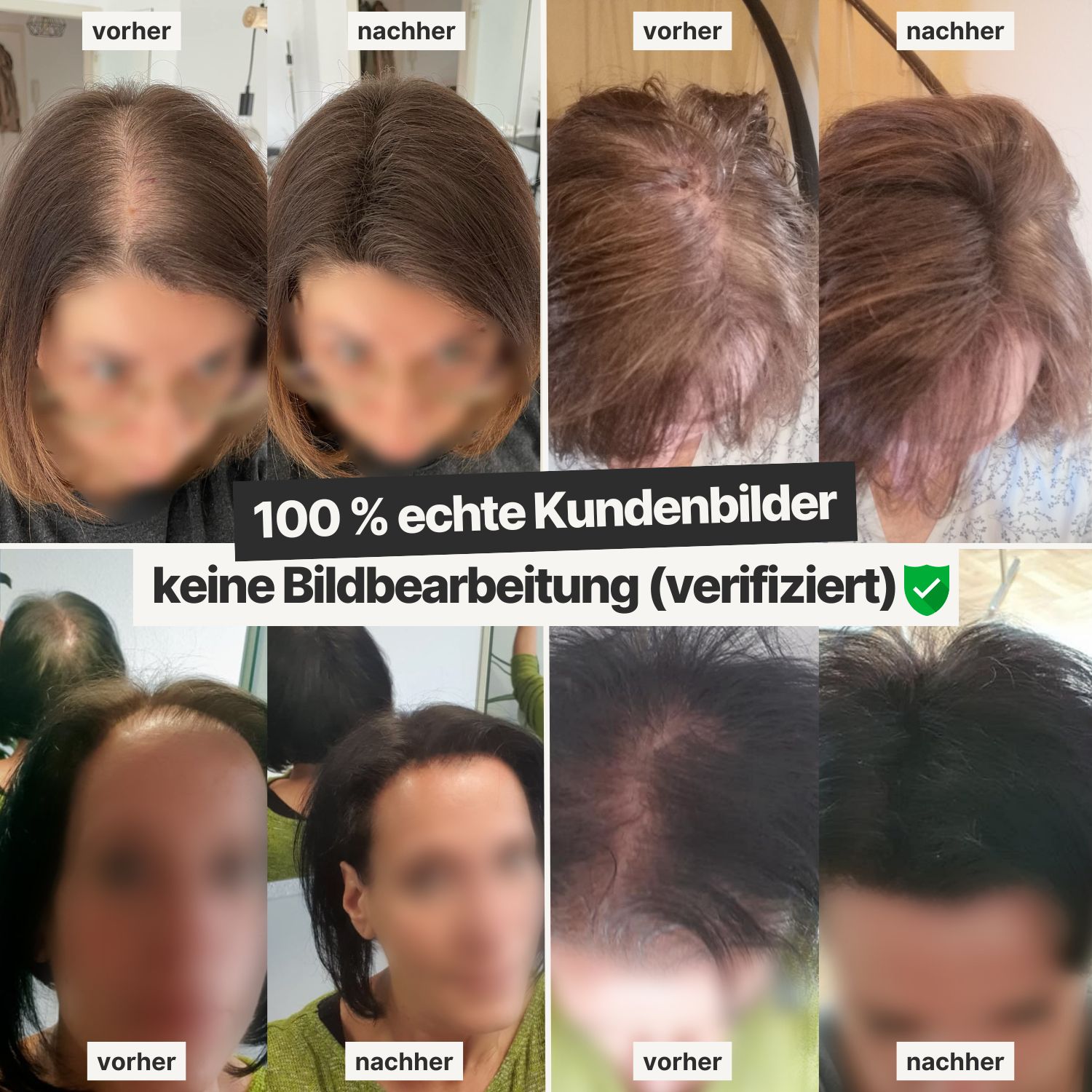 IMPERIO® Streuhaar zur Haarverdichtung - 100% Baumwolle, dermatologisch getestet
